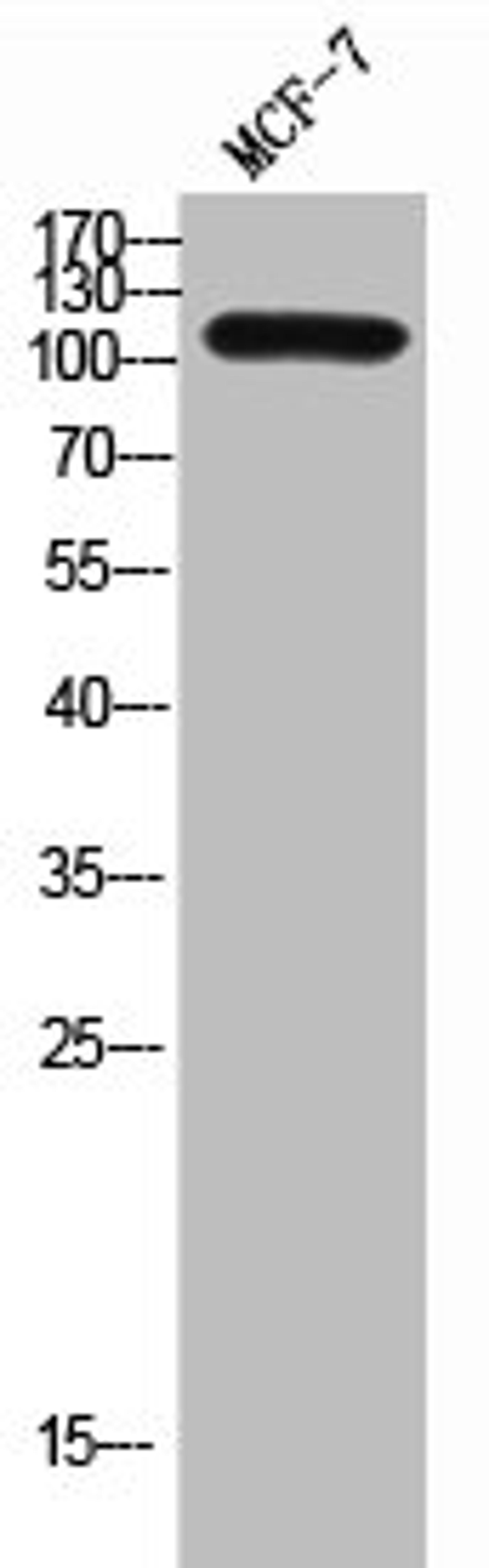 Western Blot analysis of MCF-7 cells using CD249 Polyclonal Antibody