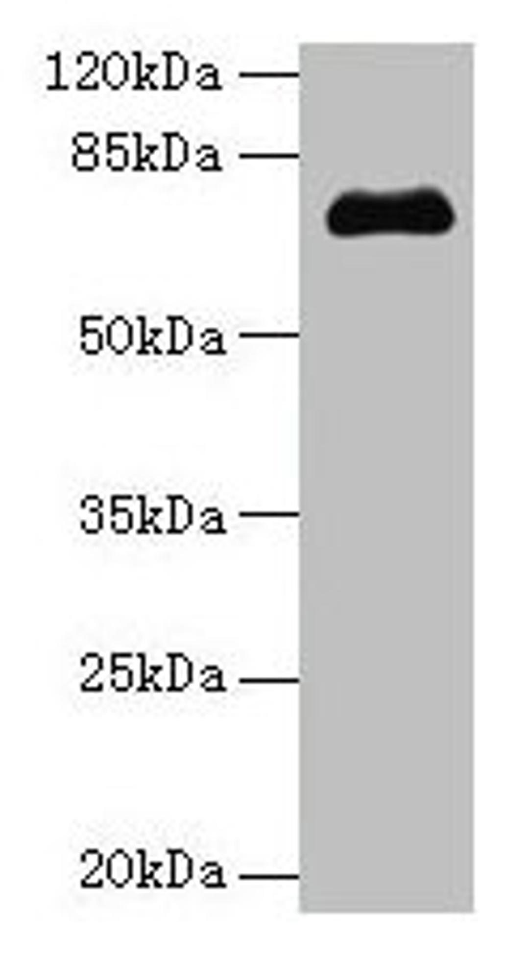 Western blot. All lanes: PMEL antibody at 14µg/ml + Jurkat whole cell lysate. Secondary. Goat polyclonal to rabbit IgG at 1/10000 dilution. Predicted band size: 71, 61, 67 kDa. Observed band size: 71 kDa