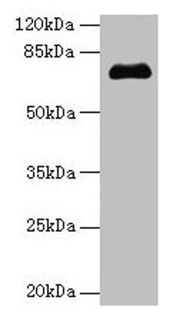 Western blot. All lanes: PMEL antibody at 14µg/ml + Jurkat whole cell lysate. Secondary. Goat polyclonal to rabbit IgG at 1/10000 dilution. Predicted band size: 71, 61, 67 kDa. Observed band size: 71 kDa