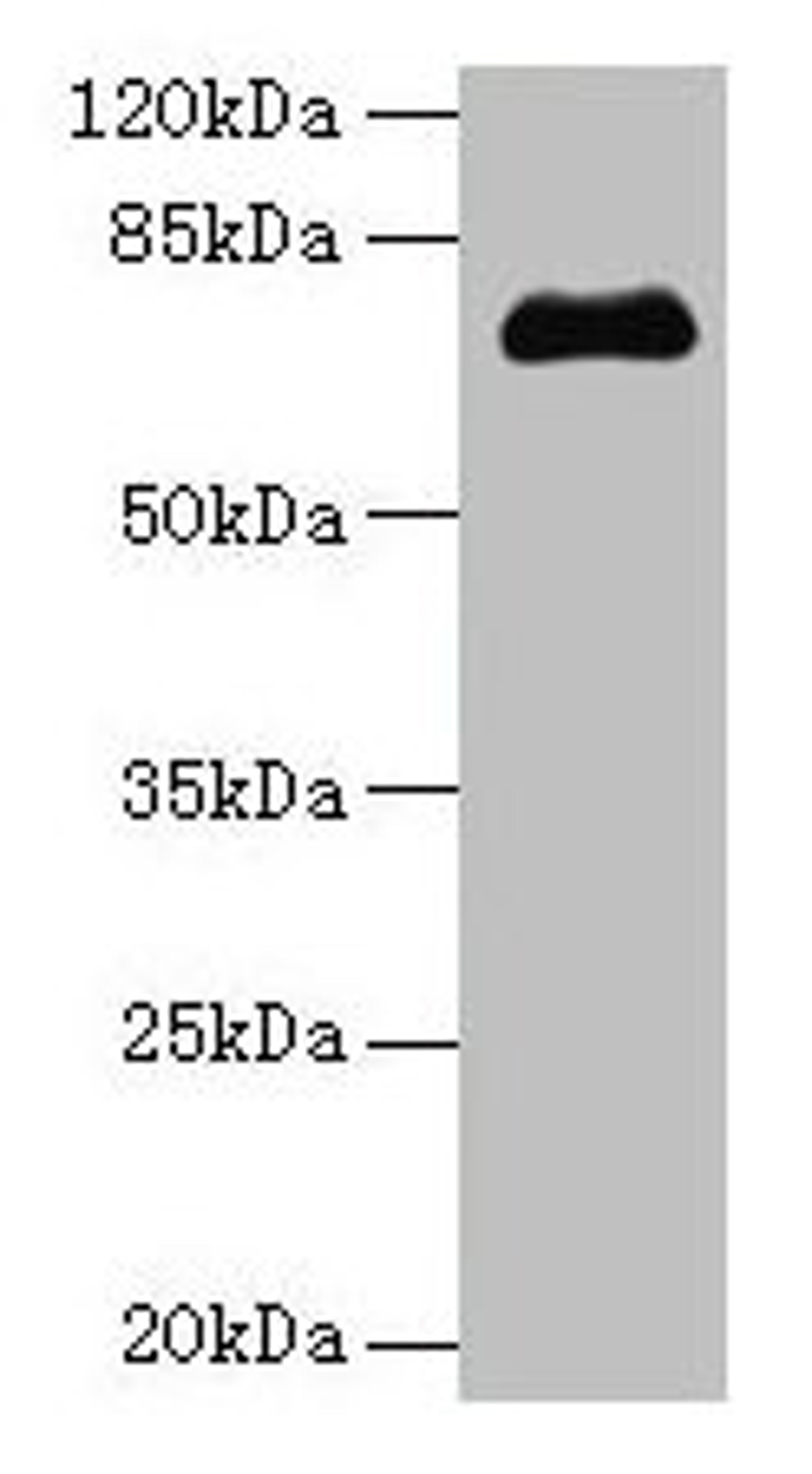 Western blot. All lanes: PMEL antibody at 14µg/ml + Jurkat whole cell lysate. Secondary. Goat polyclonal to rabbit IgG at 1/10000 dilution. Predicted band size: 71, 61, 67 kDa. Observed band size: 71 kDa