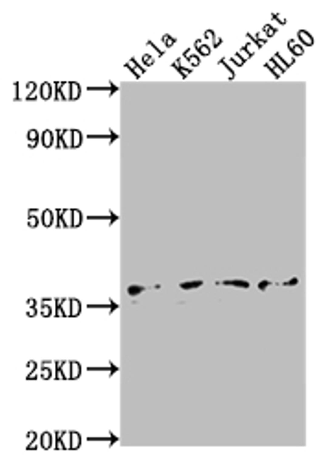 Western Blot. Positive WB detected in: Hela whole cell lysate, K562 whole cell lysate, Jurkat whole cell lysate, HL60 whole cell lysate. All lanes: TBP antibody at 1:2000. Secondary. Goat polyclonal to rabbit IgG at 1/50000 dilution. Predicted band size: 38, 36 kDa. Observed band size: 36 kDa. 