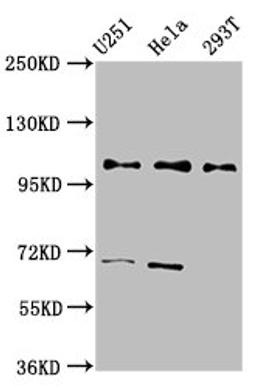 Western Blot. Positive WB detected in: U251 whole cell lysate, Hela whole cell lysate, 293T whole cell lysate. All lanes: PRPF40A antibody at 2.7ug/ml. Secondary. Goat polyclonal to rabbit IgG at 1/50000 dilution. Predicted band size: 109, 106, 107, 11 kDa. Observed band size: 109 kDa. 