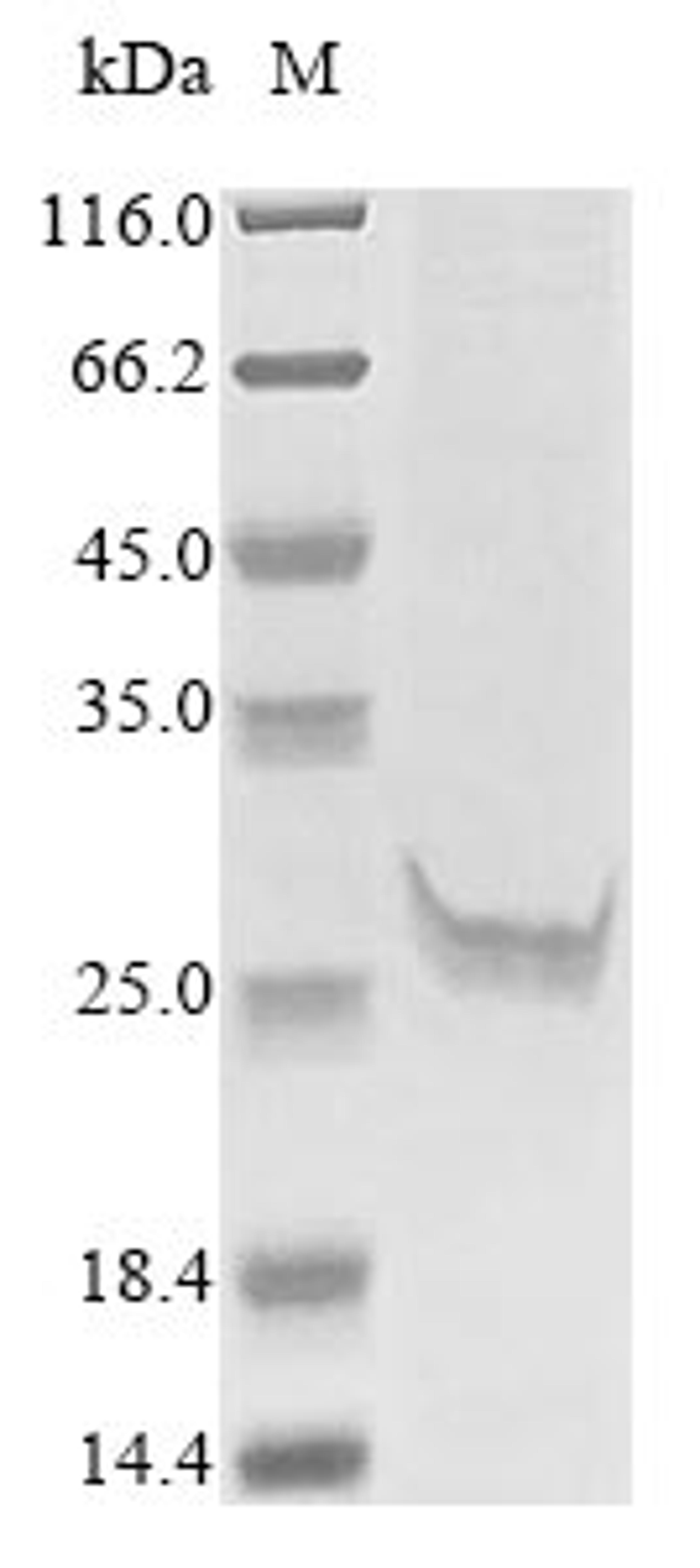 (Tris-Glycine gel) Discontinuous SDS-PAGE (reduced) with 5% enrichment gel and 15% separation gel.