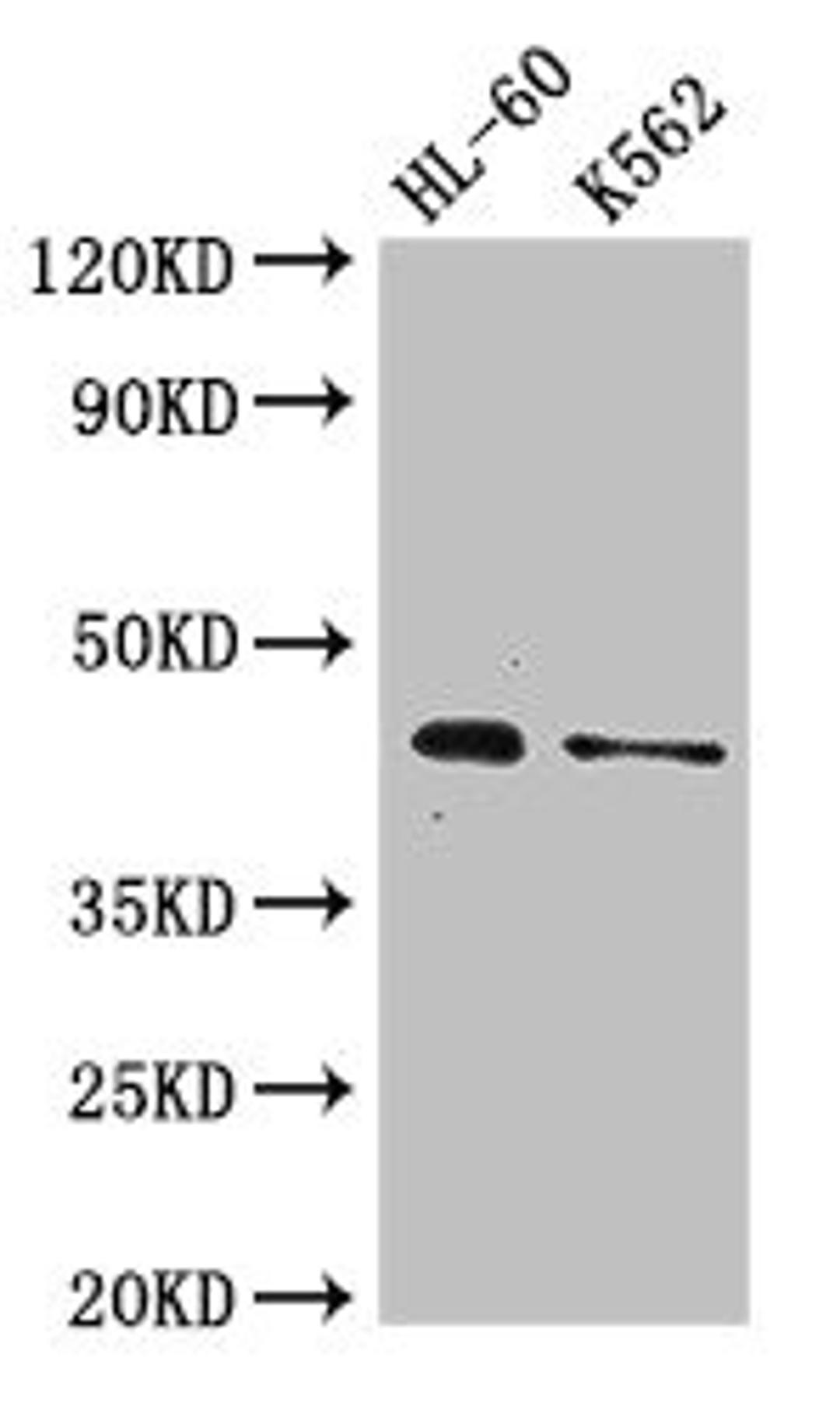 Western Blot. Positive WB detected in: HL60 whole cell lysate, K562 whole cell lysate. All lanes: MTERF1 antibody at 2.6ug/ml. Secondary. Goat polyclonal to rabbit IgG at 1/50000 dilution. Predicted band size: 46 kDa. Observed band size: 46 kDa. 