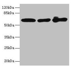 Western blot. All lanes: KRT6A antibody at 4µg/ml. Lane 1: A431 whole cell lysate. Lane 2: K562 whole cell lysate. Lane 3: MCF-7 whole cell lysate. Secondary. Goat polyclonal to rabbit IgG at 1/10000 dilution. Predicted band size: 61 kDa. Observed band size: 61 kDa