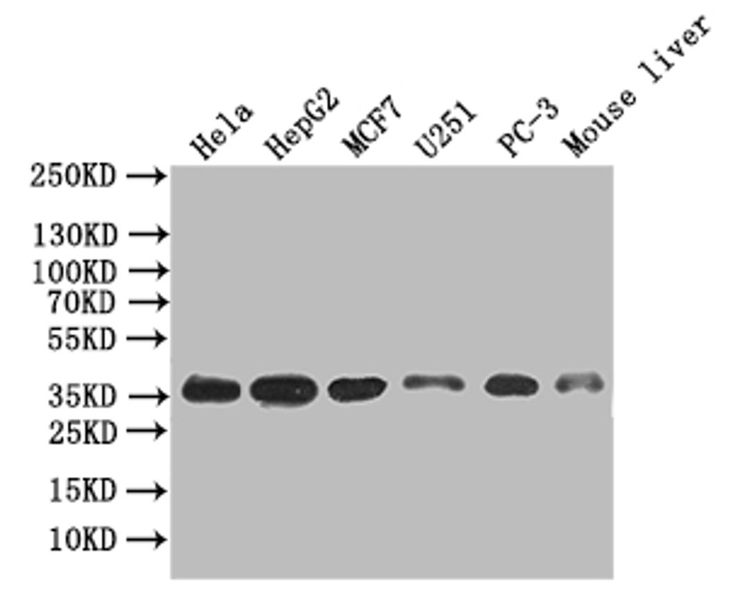 Western Blot. Positive WB detected in: Hela whole cell lysate, HepG2 whole cell lysate, MCF7 whole cell lysate, U251 whole cell lysate, PC-3 whole cell lysate, Mouse Liver tissue lysate. All lanes: ANXA4 antibody at 1:500. Secondary. Goat polyclonal to mouse IgG at 1/50000 dilution. Predicted band size: 36 kDa. Observed band size: 36 kDa. 