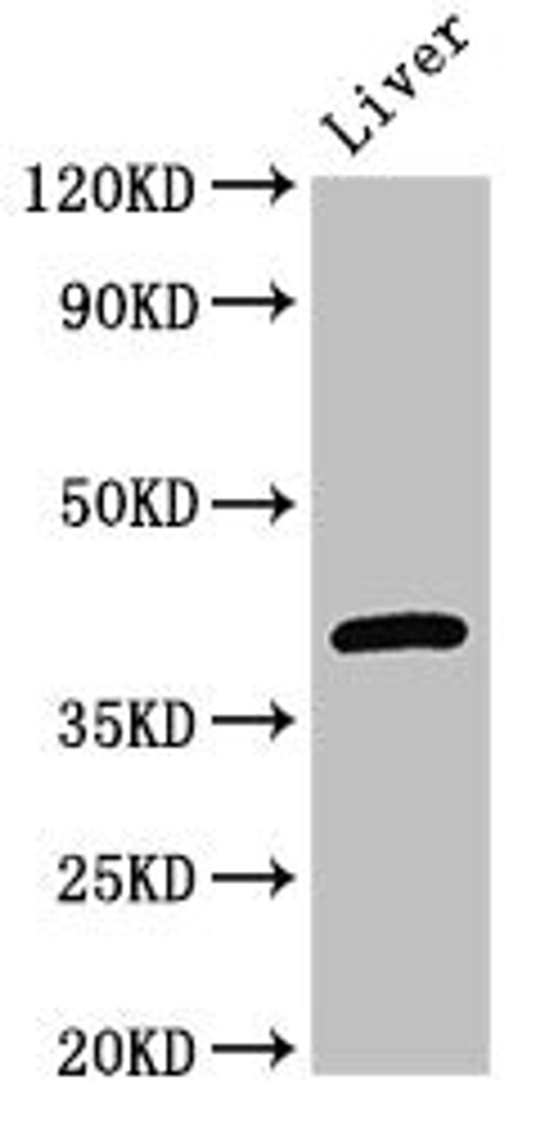 Western Blot. Positive WB detected in: Mouse liver tissue. All lanes: GNAT1 antibody at 3ug/ml. Secondary. Goat polyclonal to rabbit IgG at 1/50000 dilution. Predicted band size: 41 kDa. Observed band size: 41 kDa. 