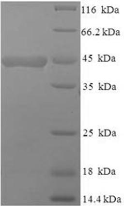 (Tris-Glycine gel) Discontinuous SDS-PAGE (reduced) with 5% enrichment gel and 15% separation gel.
