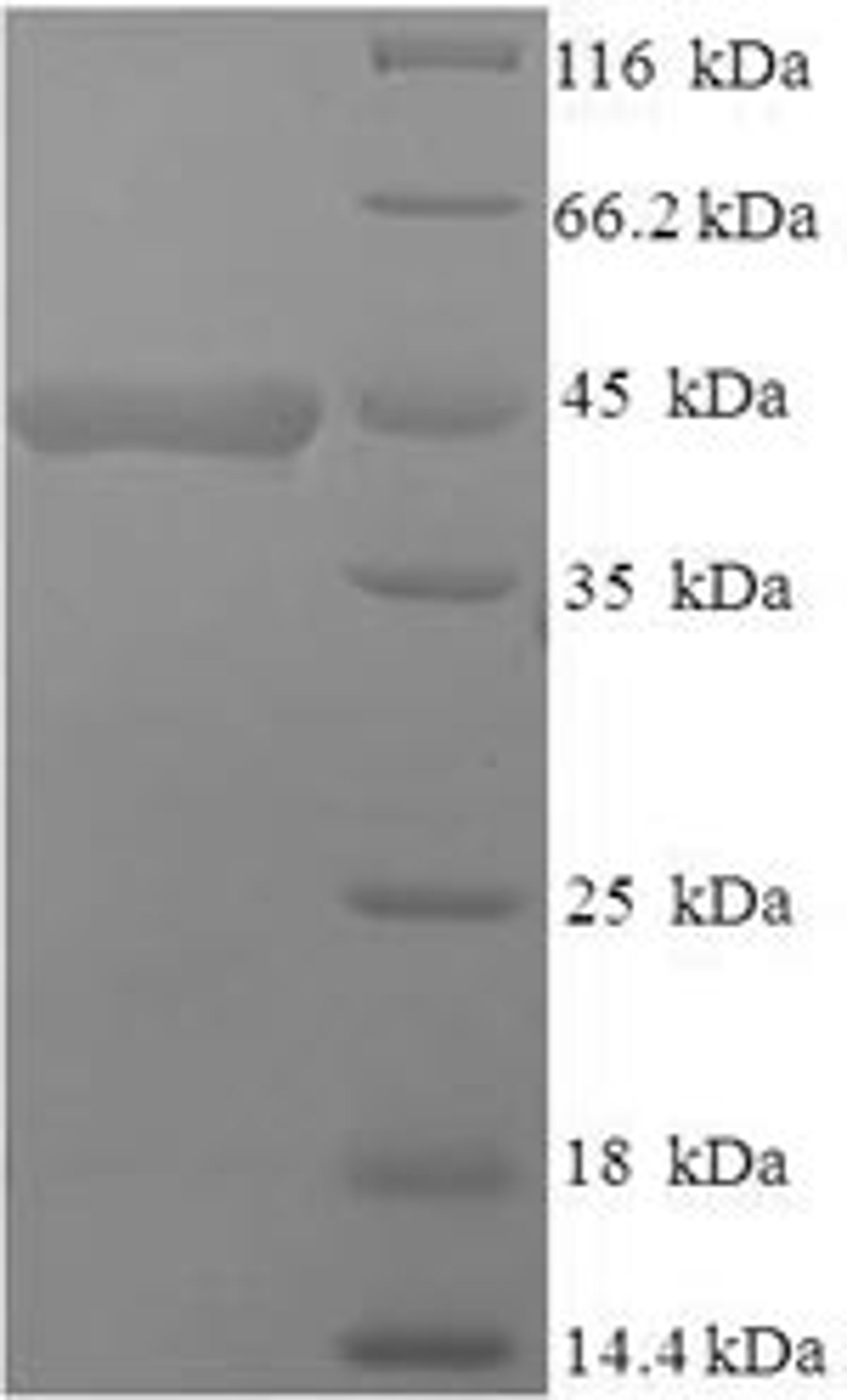 (Tris-Glycine gel) Discontinuous SDS-PAGE (reduced) with 5% enrichment gel and 15% separation gel.
