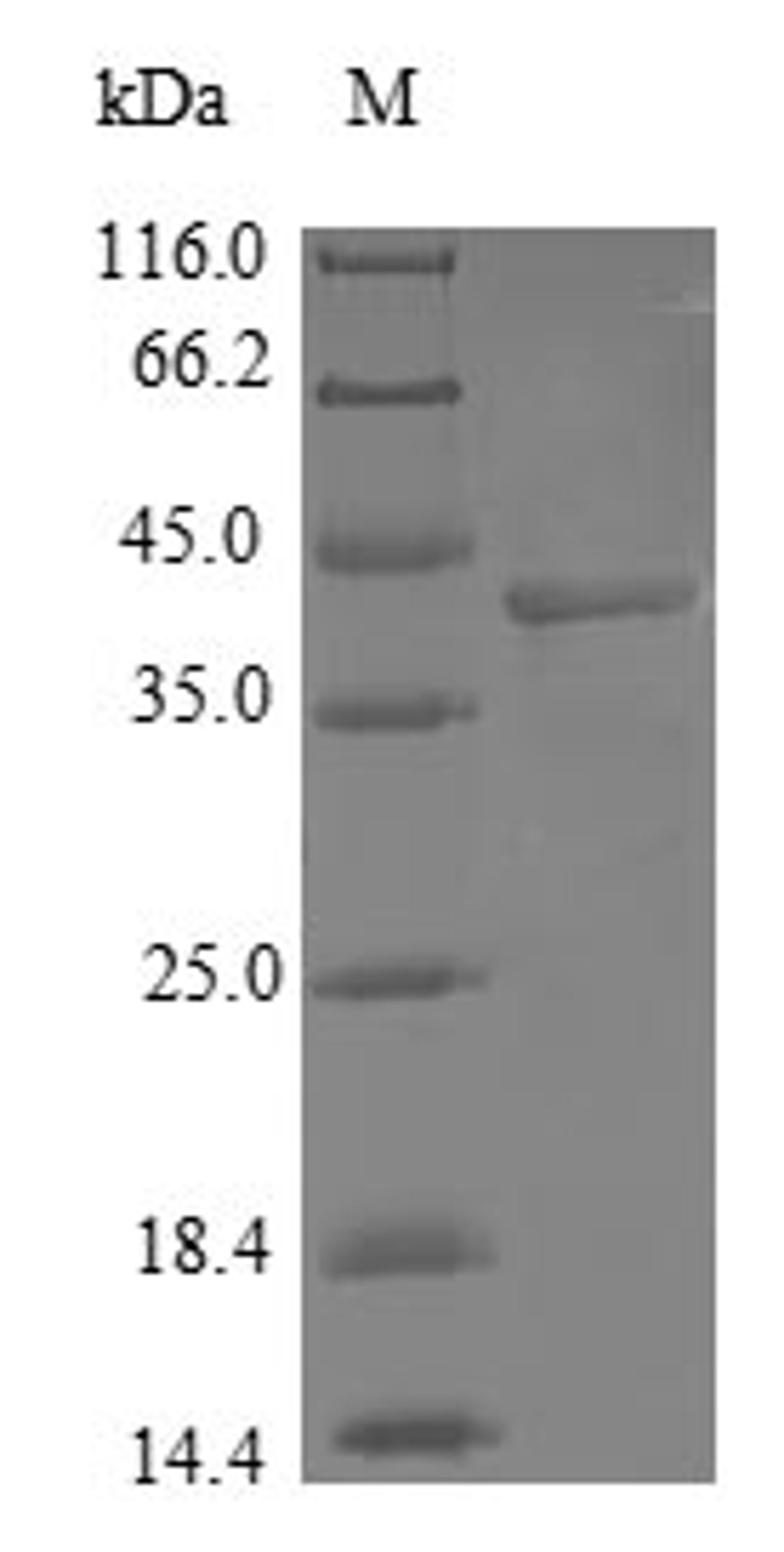 (Tris-Glycine gel) Discontinuous SDS-PAGE (reduced) with 5% enrichment gel and 15% separation gel.