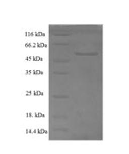 (Tris-Glycine gel) Discontinuous SDS-PAGE (reduced) with 5% enrichment gel and 15% separation gel.