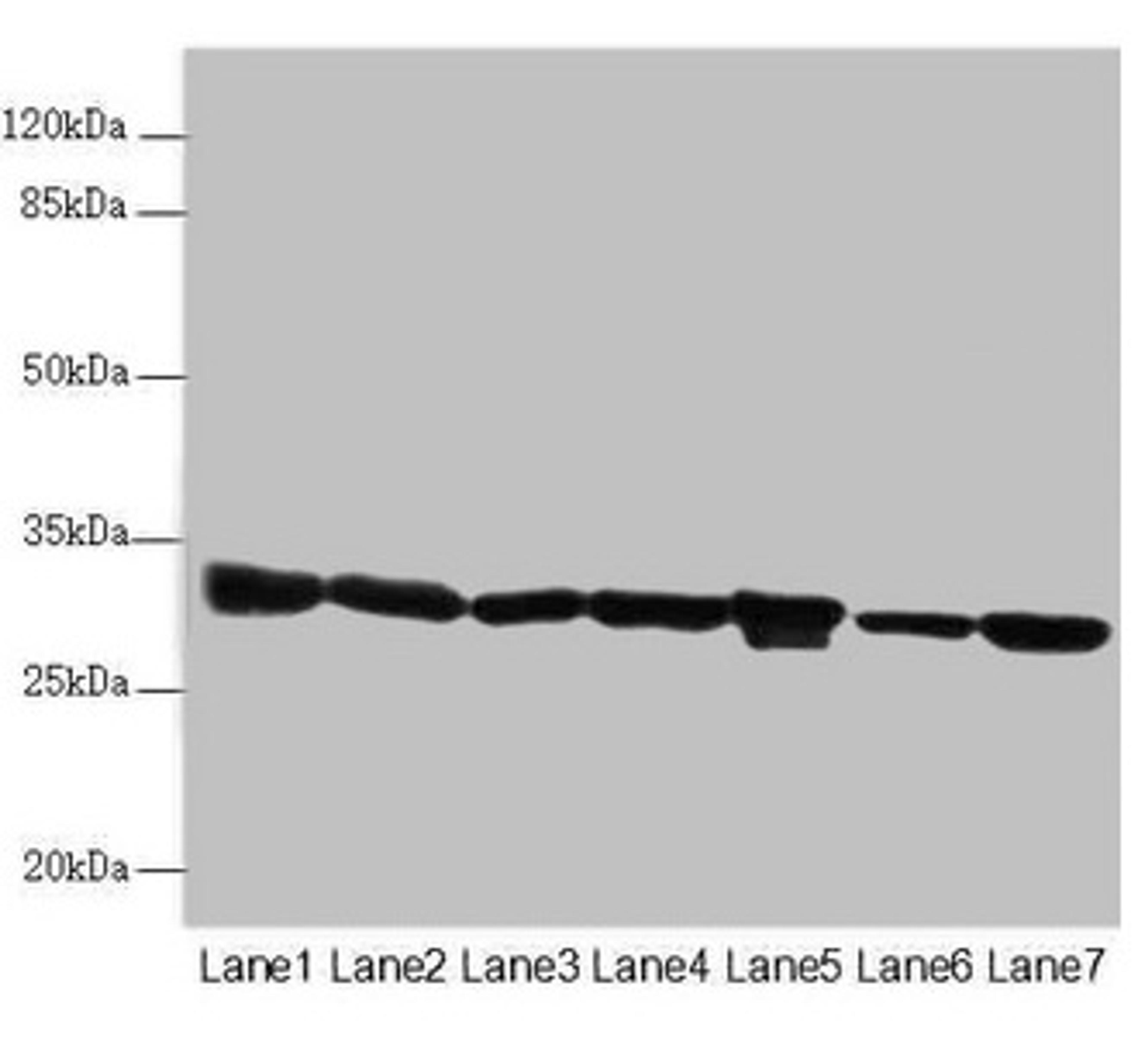 Western blot. All lanes: ECHS1 antibody at 3.03µg/ml. Lane 1: Mouse liver tissue. Lane 2: Mouse skeletal muscle tissue. Lane 3: Hela whole cell lysate. Lane 4: HepG2 whole cell lysate. Lane 5: MCF-7 whole cell lysate. Lane 6: Jurkat whole cell lysate. Lane 7: A549 whole cell lysate. Secondary. Goat polyclonal to rabbit IgG at 1/10000 dilution. Predicted band size: 32 kDa. Observed band size: 32 kDa