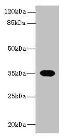 Western blot. All lanes: OR2H1 antibody at 0.5ug/ml + Mouse liver tissue. Secondary. Goat polyclonal to rabbit IgG at 1/10000 dilution. Predicted band size: 35 kDa. Observed band size: 35 kDa. 