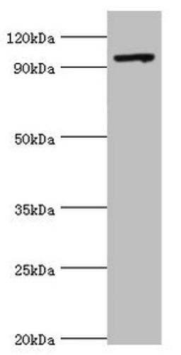 Western blot. All lanes: TAF1C antibody at 2ug/ml + 293T whole cell lysate. Secondary. Goat polyclonal to rabbit IgG at 1/10000 dilution. Predicted band size: 96, 85, 59, 50, 93 kDa. Observed band size: 96 kDa. 