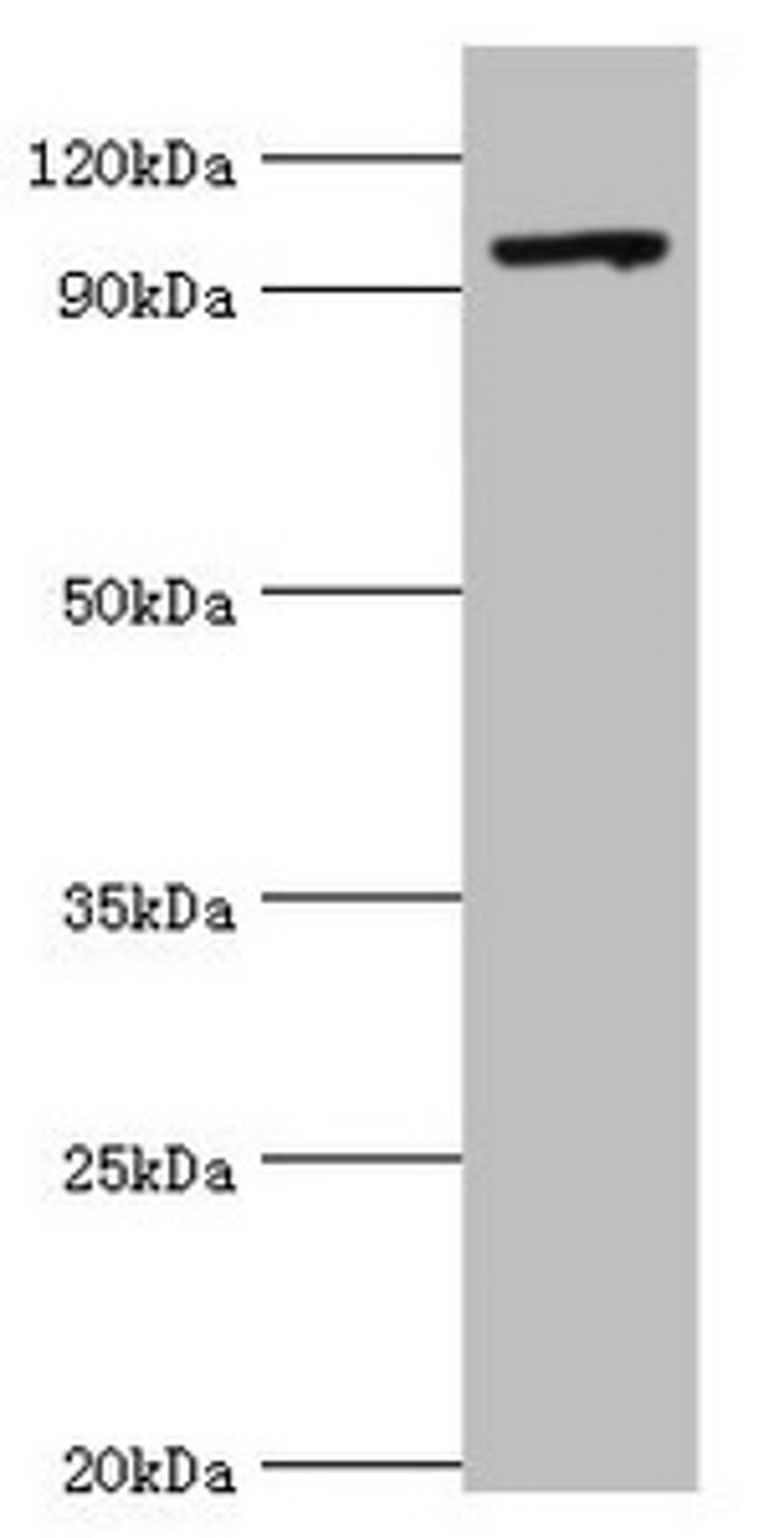 Western blot. All lanes: TAF1C antibody at 2ug/ml + 293T whole cell lysate. Secondary. Goat polyclonal to rabbit IgG at 1/10000 dilution. Predicted band size: 96, 85, 59, 50, 93 kDa. Observed band size: 96 kDa. 