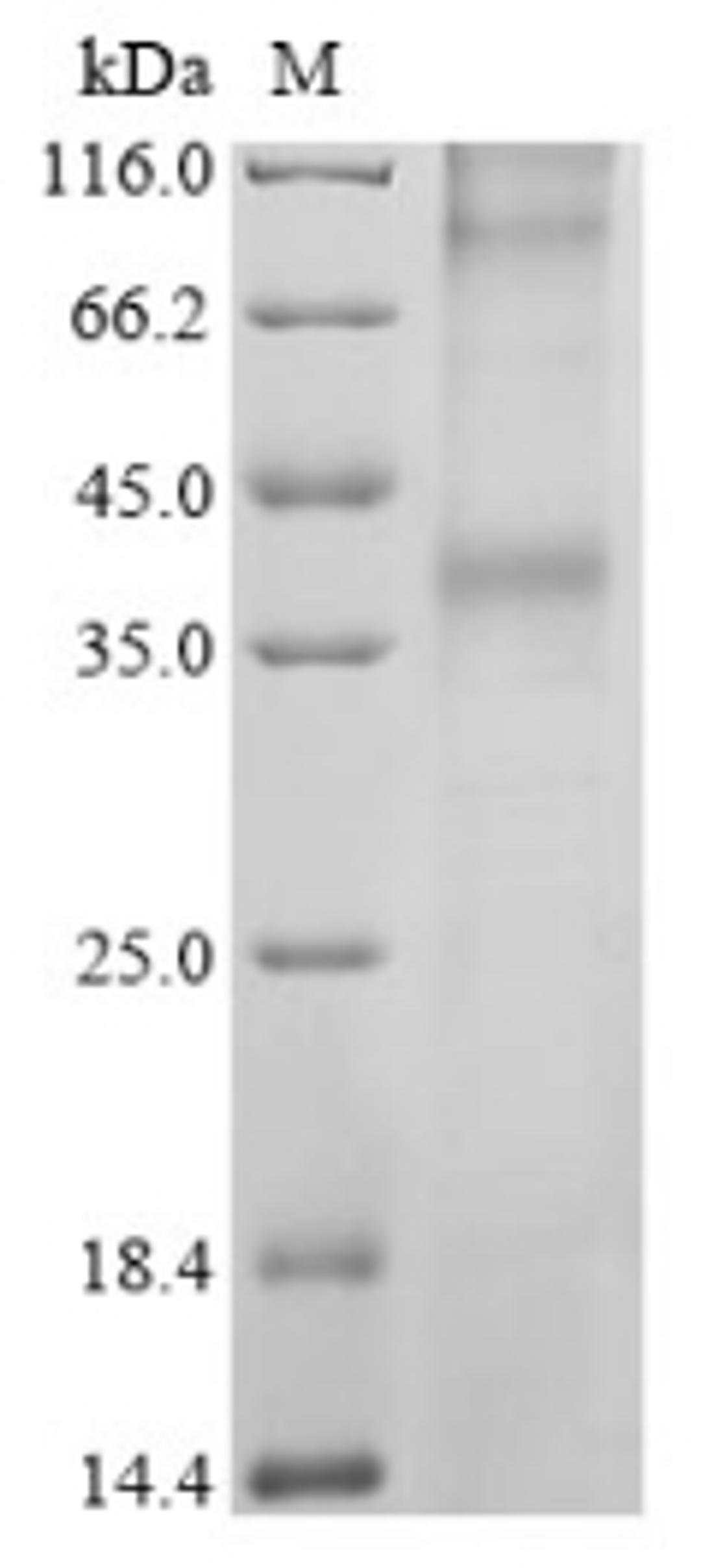 (Tris-Glycine gel) Discontinuous SDS-PAGE (reduced) with 5% enrichment gel and 15% separation gel.