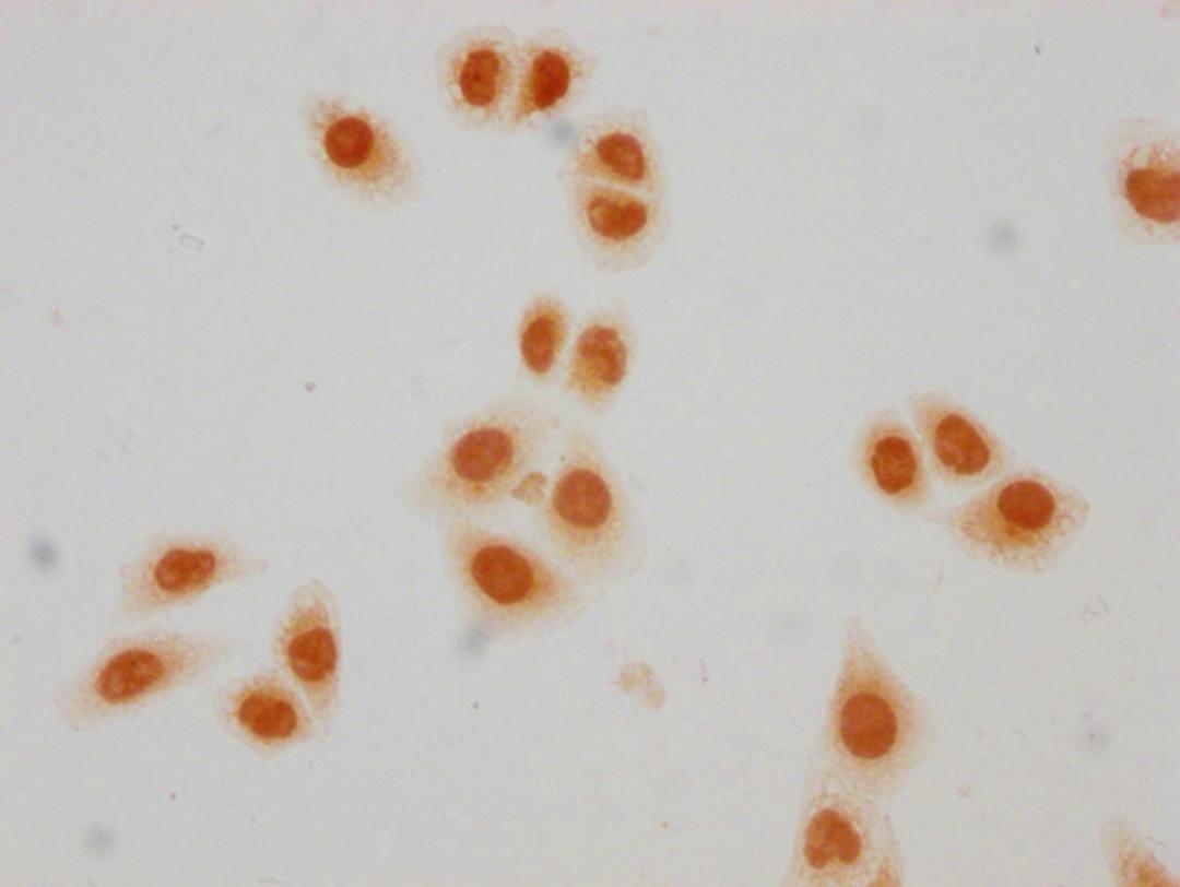 Immunocytochemistry analysis of CSB-PA010403PA23crHU diluted at 1:50 and staining in Hela cells(treated with 30mM sodium crotonylate for 4h) performed on a Leica BondTM system. The cells were fixed in 4% formaldehyde, permeabilized using 0.2% Triton X-100 and blocked with 10% normal goat serum 30min at RT. Then primary antibody (1% BSA) was incubated at 4°C overnight. The primary is detected by a biotinylated secondary antibody and visualized using an HRP conjugated SP system.