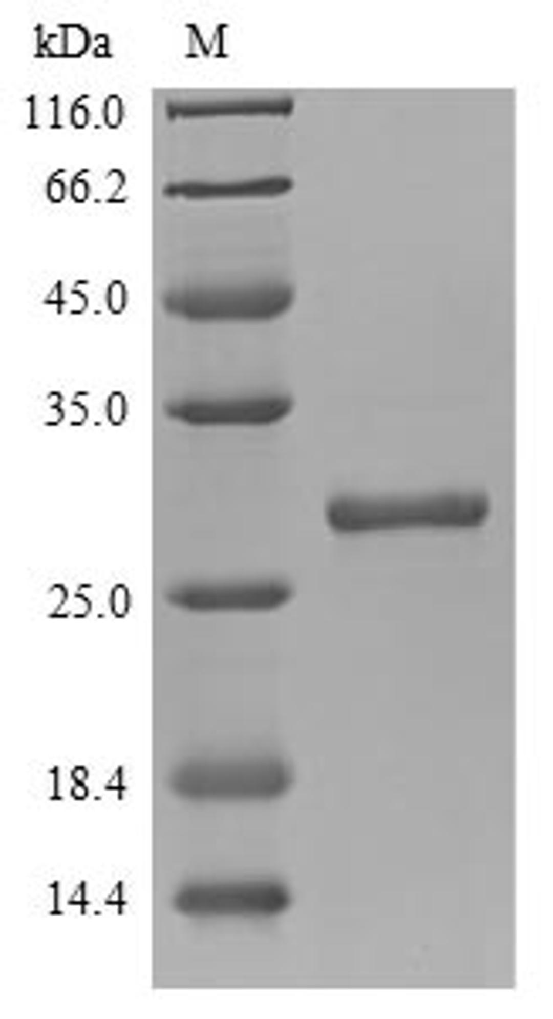 (Tris-Glycine gel) Discontinuous SDS-PAGE (reduced) with 5% enrichment gel and 15% separation gel.