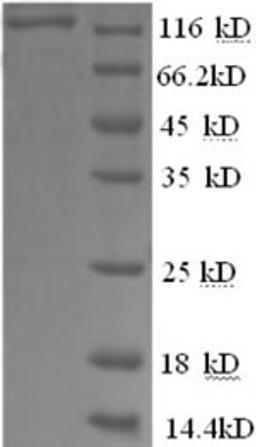(Tris-Glycine gel) Discontinuous SDS-PAGE (reduced) with 5% enrichment gel and 15% separation gel.