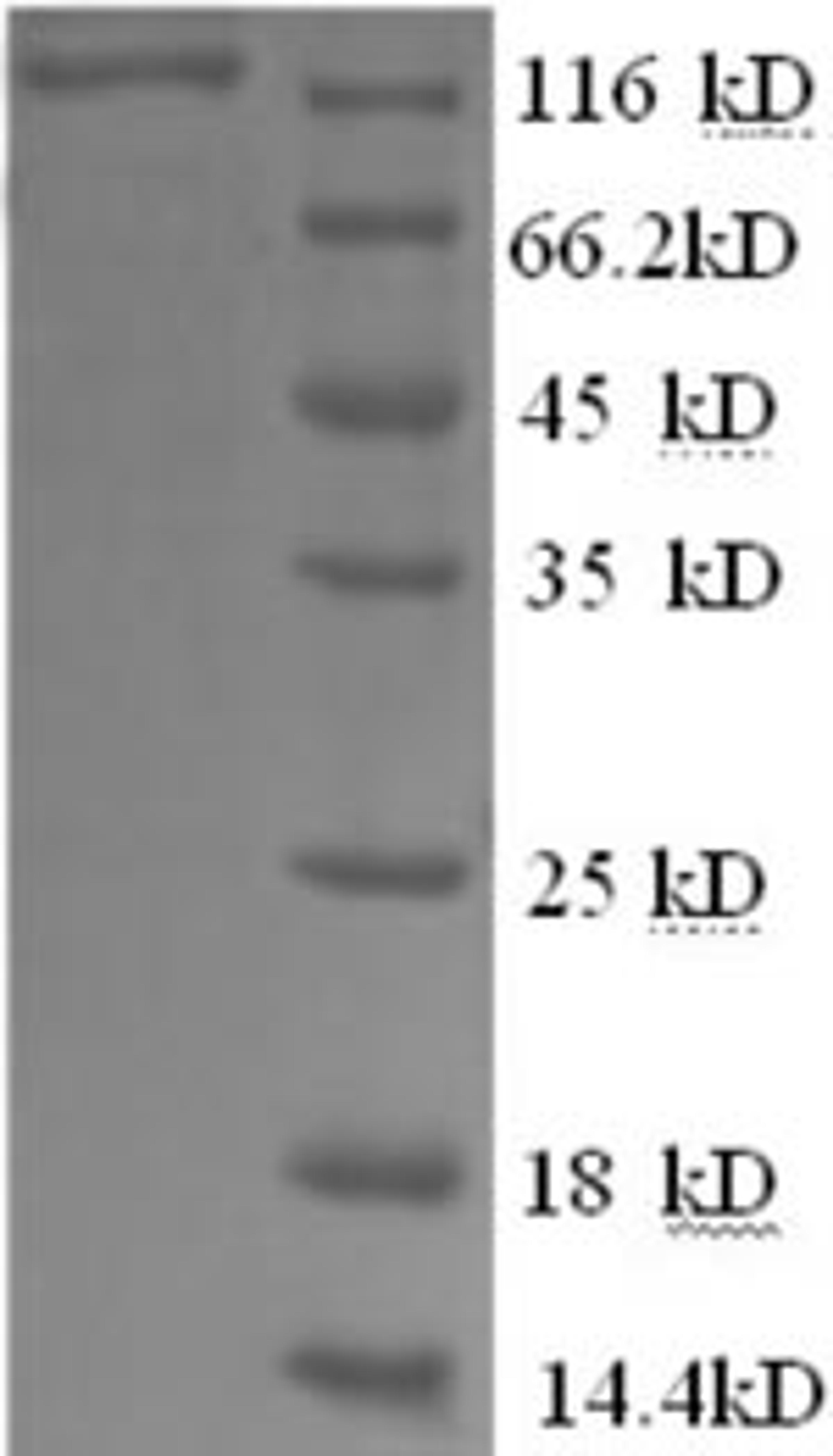 (Tris-Glycine gel) Discontinuous SDS-PAGE (reduced) with 5% enrichment gel and 15% separation gel.