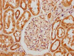 IHC image of CSB-PA017273LA01HU diluted at 1:300 and staining in paraffin-embedded human kidney tissue performed on a Leica BondTM system. After dewaxing and hydration, antigen retrieval was mediated by high pressure in a citrate buffer (pH 6.0). Section was blocked with 10% normal goat serum 30min at RT. Then primary antibody (1% BSA) was incubated at 4&deg;C overnight. The primary is detected by a biotinylated secondary antibody and visualized using an HRP conjugated SP system.