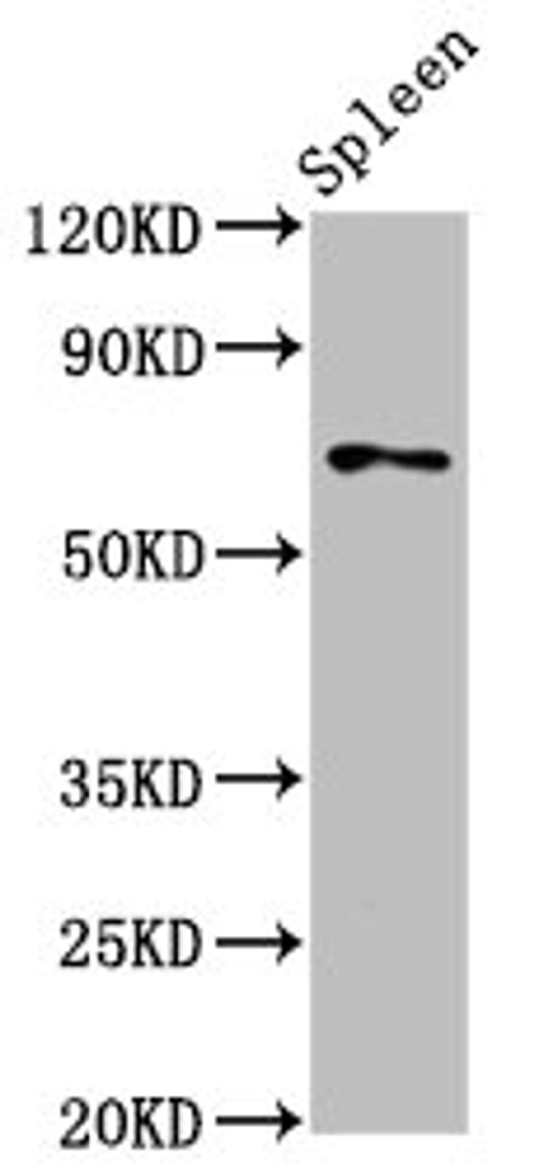 Western Blot. Positive WB detected in: Rat spleen tissue. All lanes: SSH3 antibody at 5.3ug/ml. Secondary. Goat polyclonal to rabbit IgG at 1/50000 dilution. Predicted band size: 73, 53, 57, 43, 17 kDa. Observed band size: 73 kDa. 