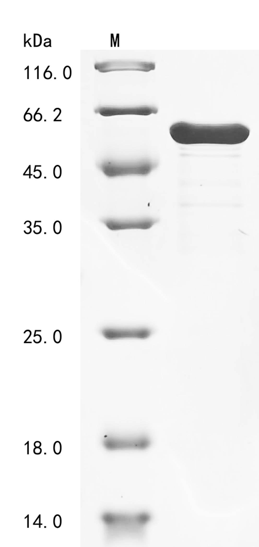 (Tris-Glycine gel) Discontinuous SDS-PAGE (reduced) with 5% enrichment gel and 15% separation gel.