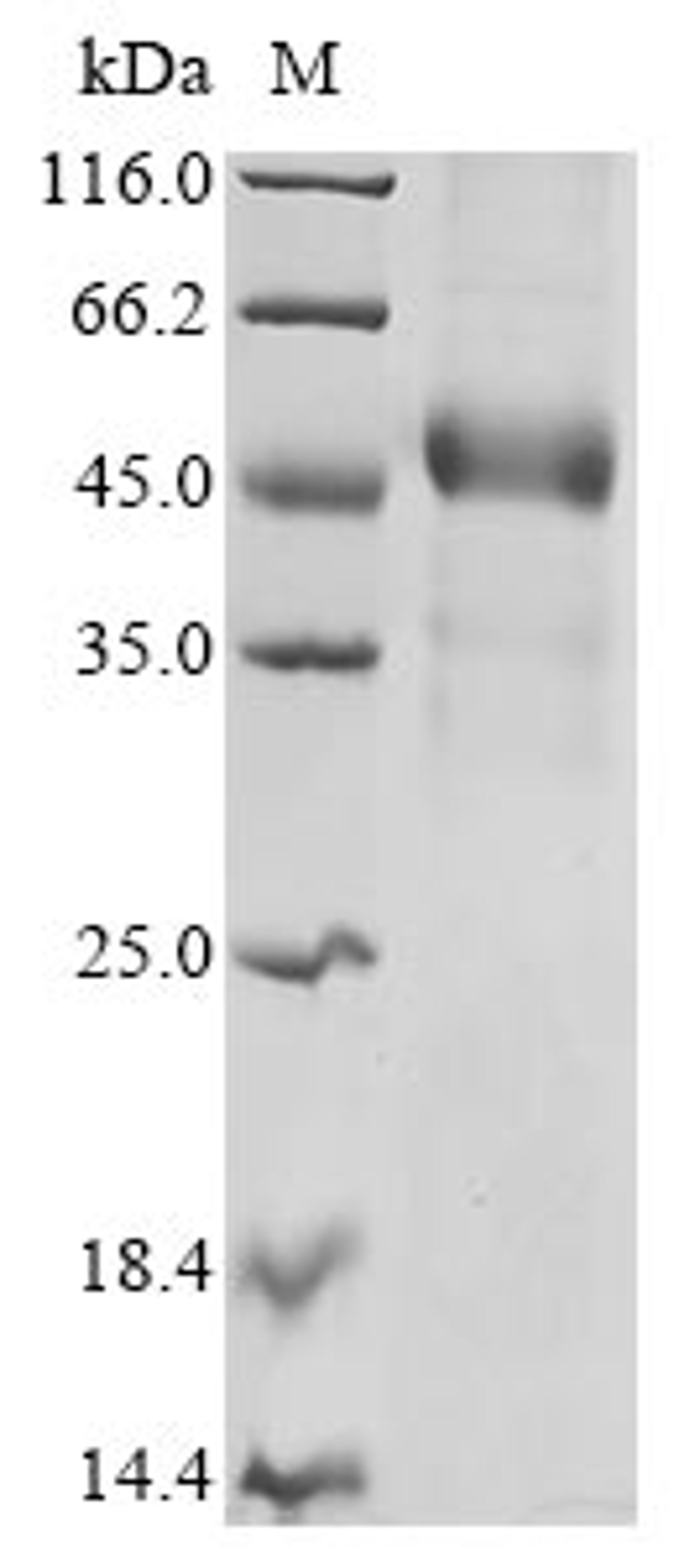 (Tris-Glycine gel) Discontinuous SDS-PAGE (reduced) with 5% enrichment gel and 15% separation gel.