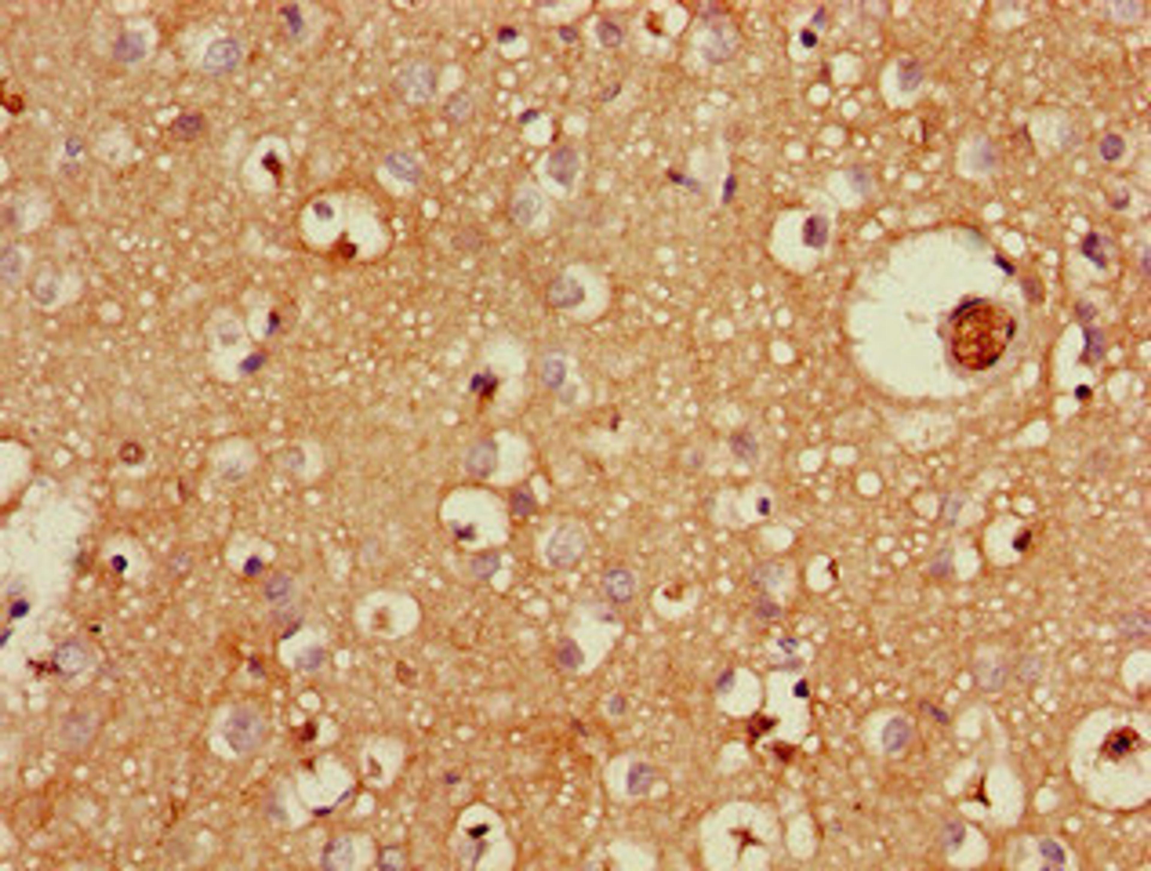 Immunohistochemistry of paraffin-embedded human brain tissue using CSB-PA734654LA01HU at dilution of 1:100