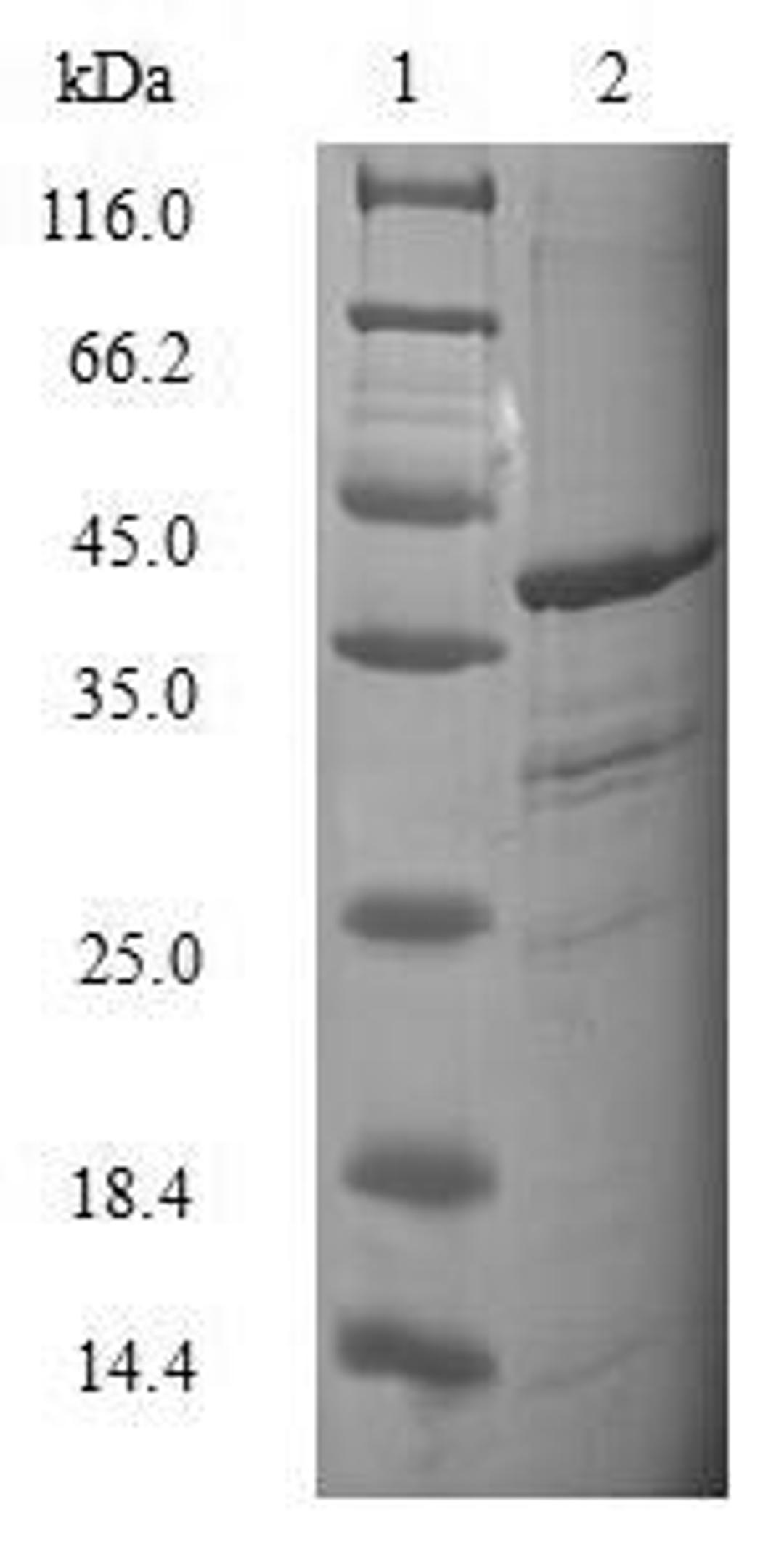 (Tris-Glycine gel) Discontinuous SDS-PAGE (reduced) with 5% enrichment gel and 15% separation gel.