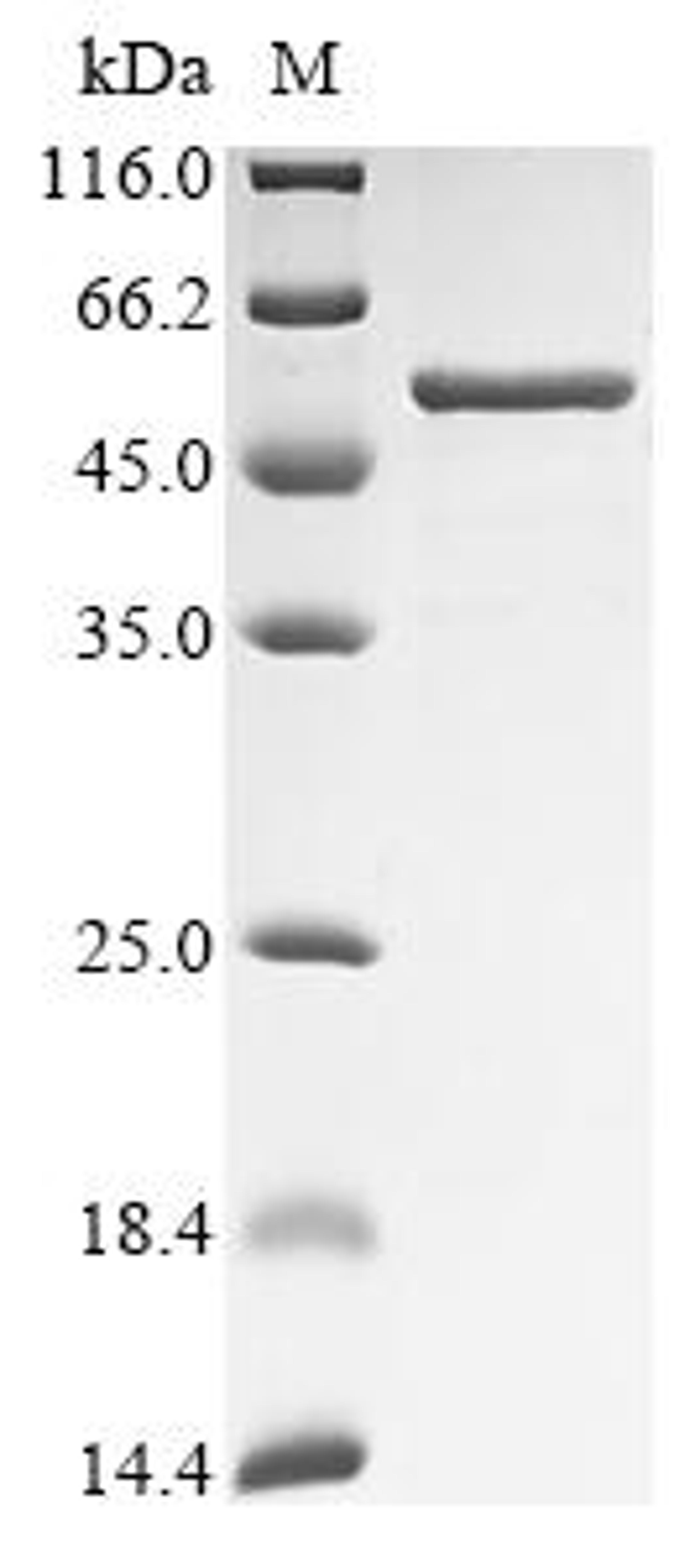 (Tris-Glycine gel) Discontinuous SDS-PAGE (reduced) with 5% enrichment gel and 15% separation gel.