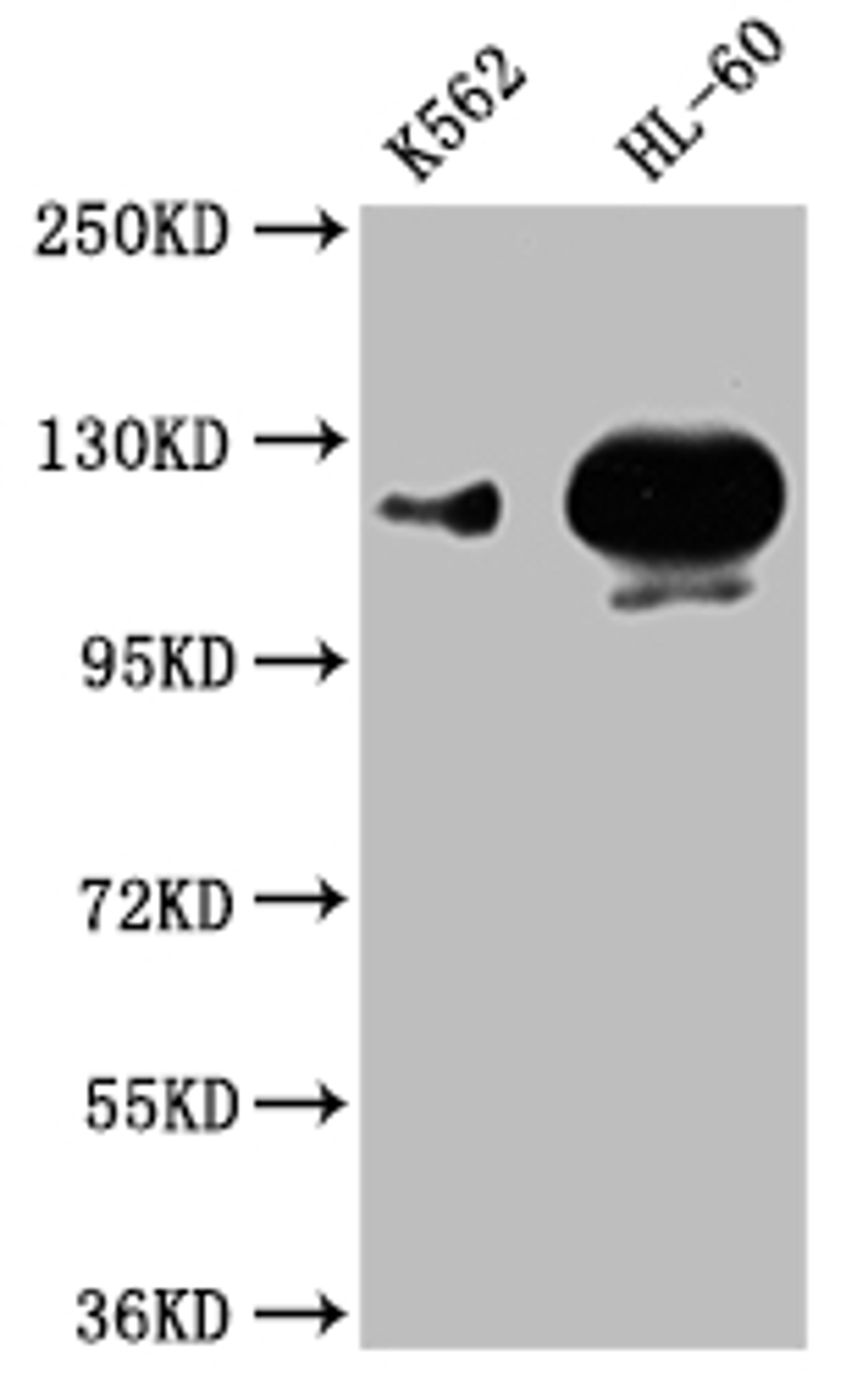 Western Blot. Positive WB detected in: K562 whole cell lysate,HL-60 whole cell lysate. All lanes: POTEE antibody at 1:1000. Secondary. Goat polyclonal to rabbit IgG at 1/50000 dilution. Predicted band size: 122 kDa. Observed band size: 122 kDa. 