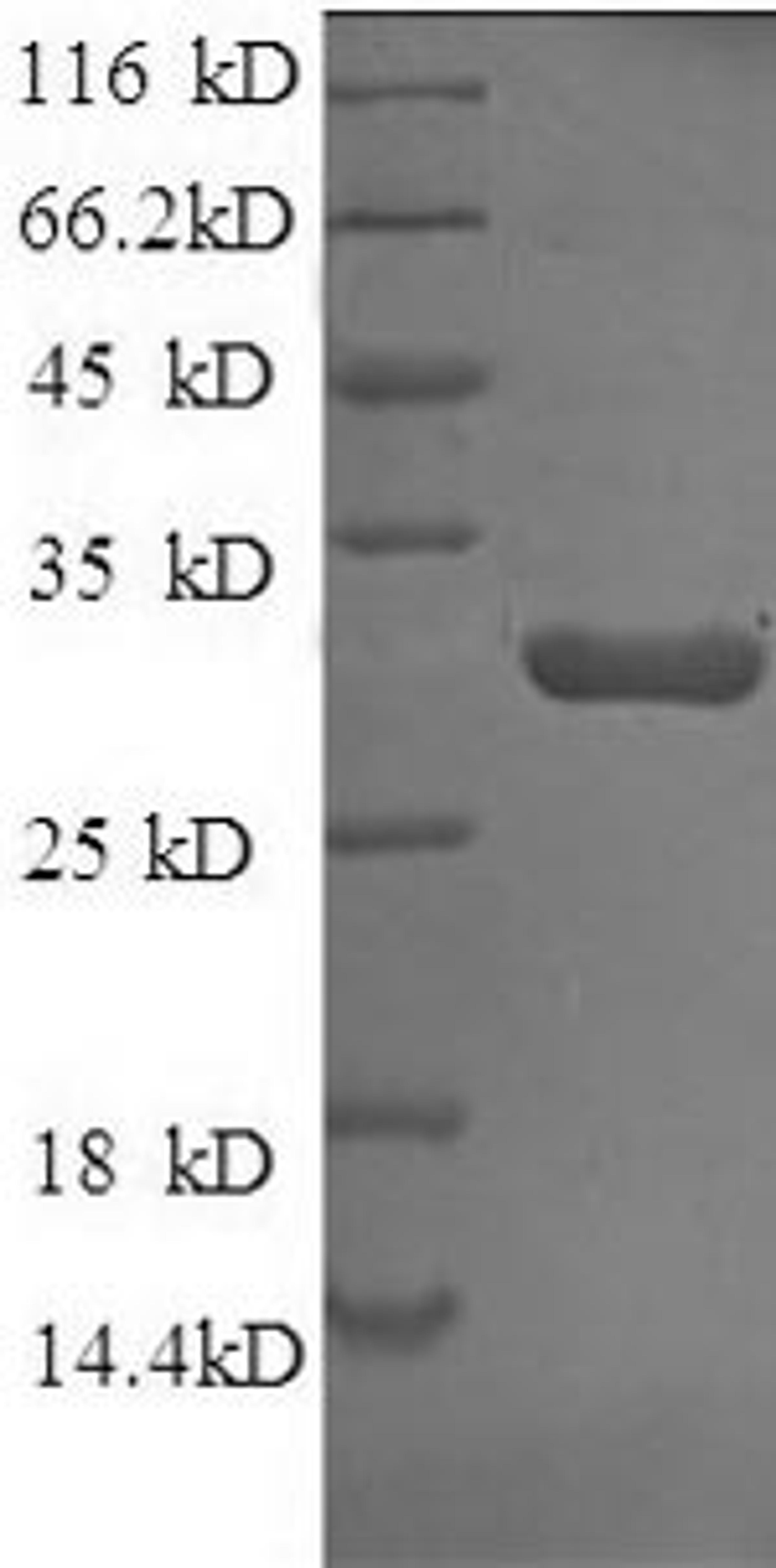 (Tris-Glycine gel) Discontinuous SDS-PAGE (reduced) with 5% enrichment gel and 15% separation gel.