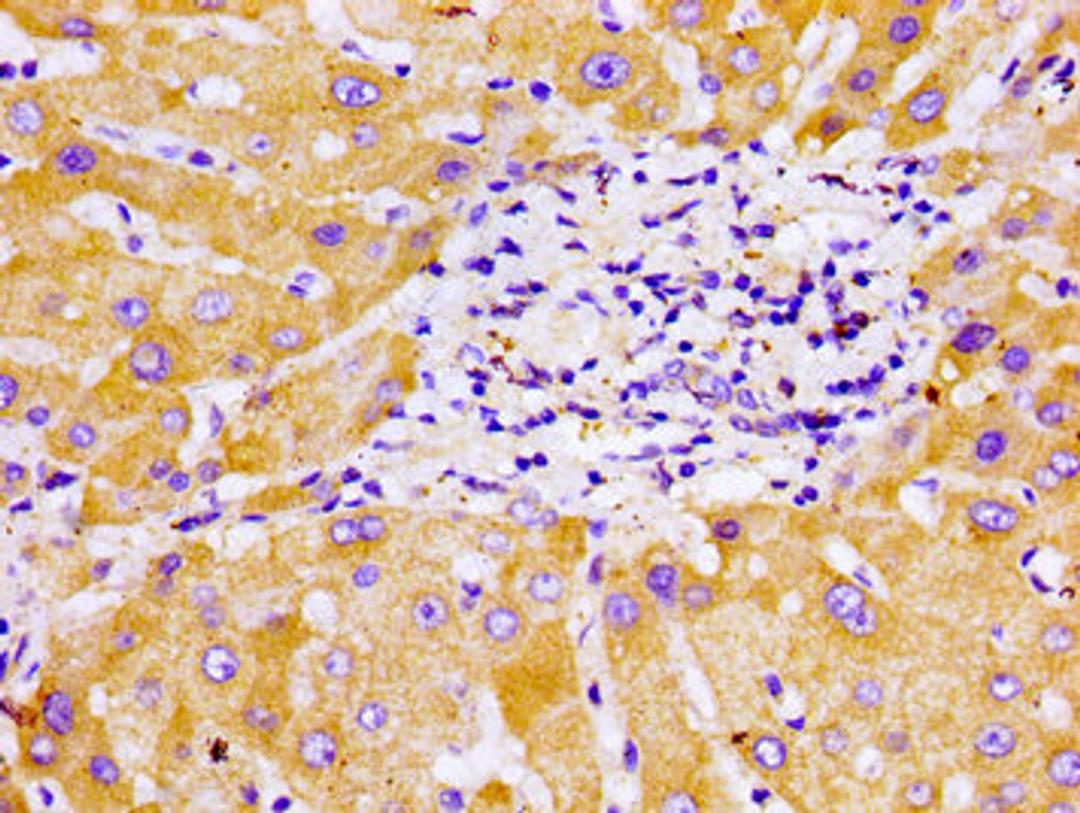 Immunohistochemistry of paraffin-embedded human liver tissue using CSB-PA006414LA01HU at dilution of 1:100