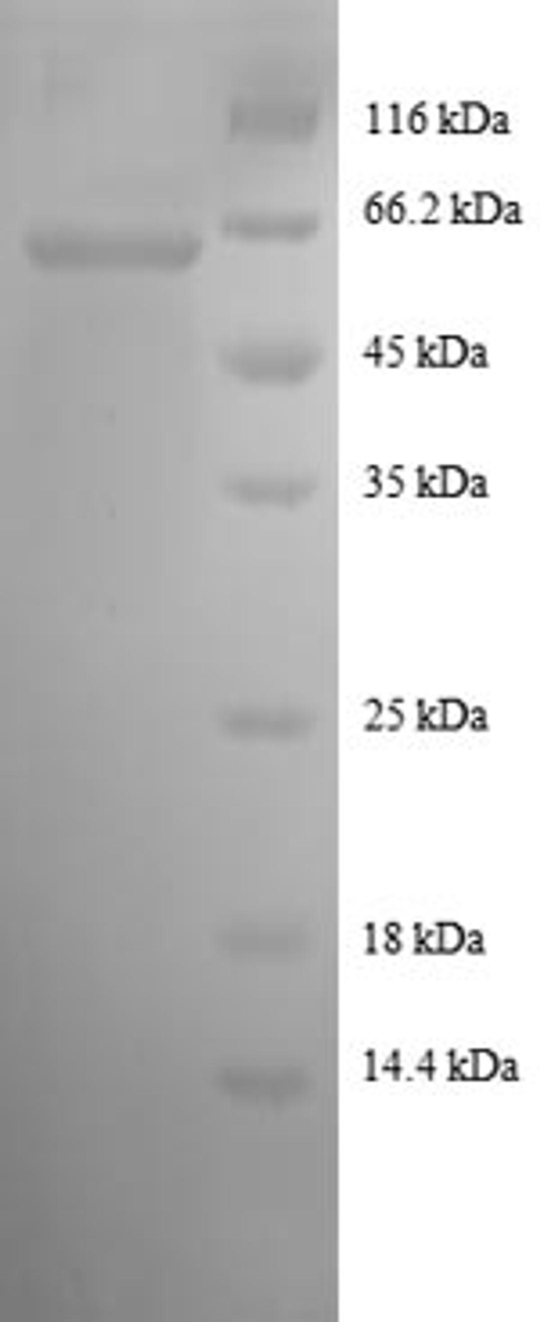 (Tris-Glycine gel) Discontinuous SDS-PAGE (reduced) with 5% enrichment gel and 15% separation gel.