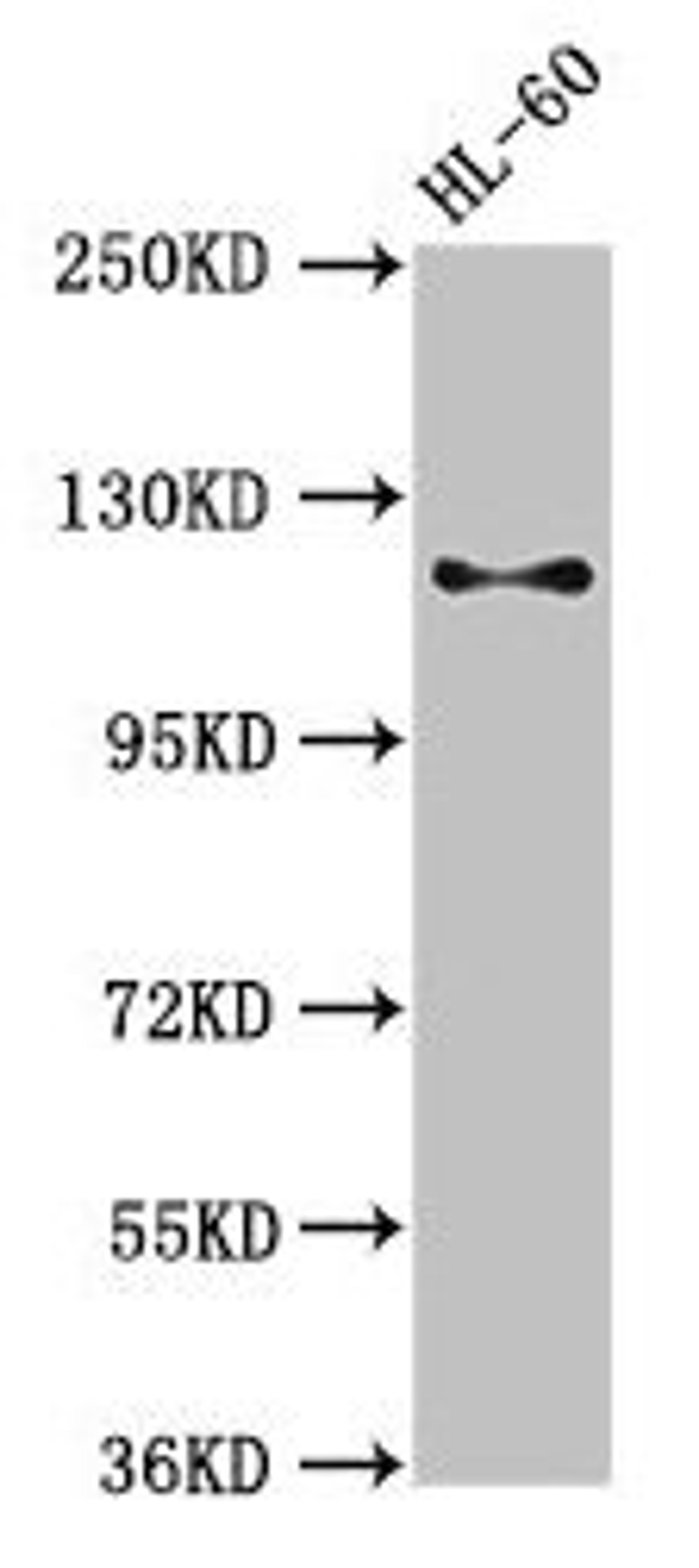 Western Blot. Positive WB detected in: HL60 whole cell lysate. All lanes: Cd163 antibody at 3µg/ml. Secondary. Goat polyclonal to rabbit IgG at 1/50000 dilution. Predicted band size: 121, 126 kDa. Observed band size: 121 kDa