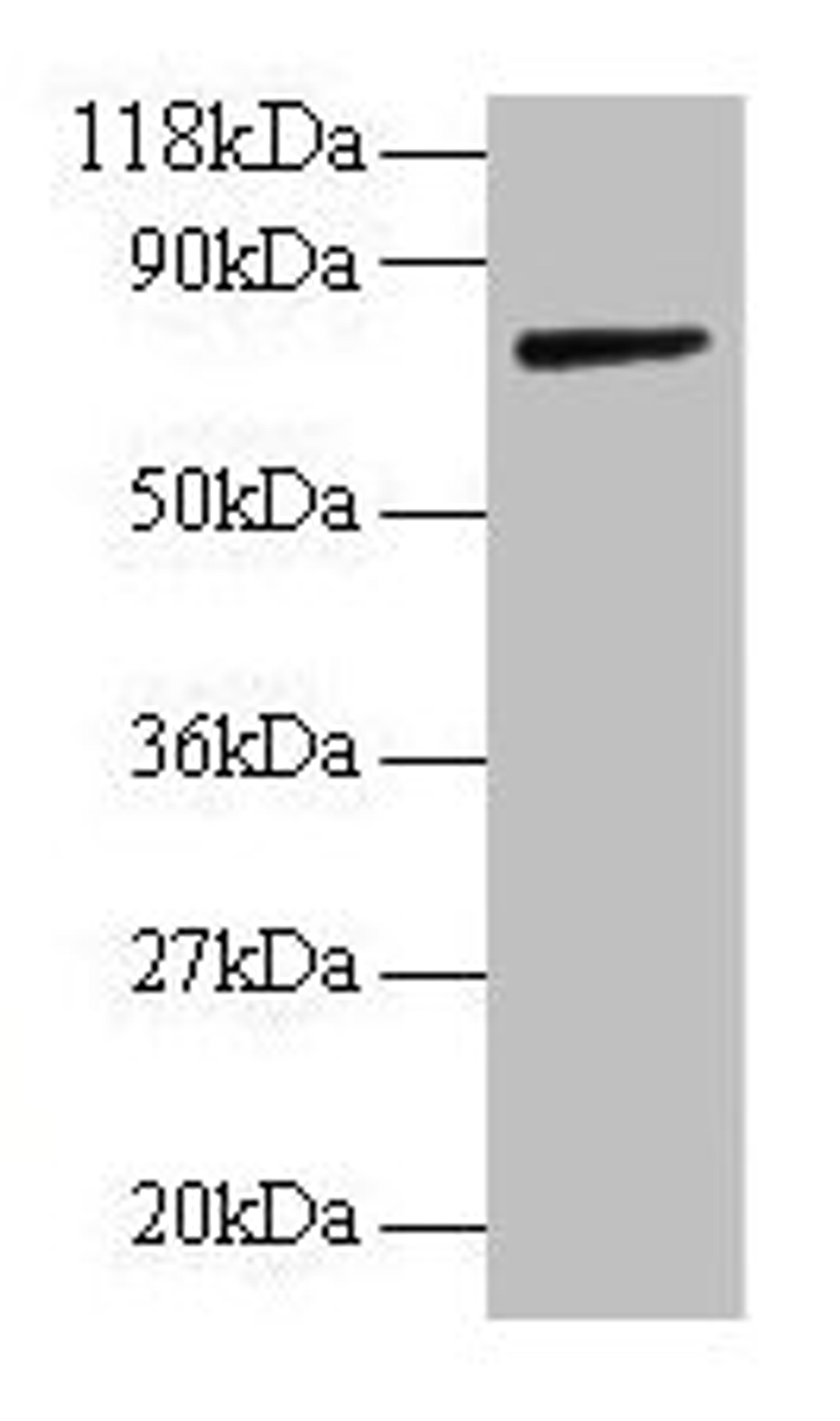 Western blot. All lanes: ANXA6 antibody at 2µg/ml + Rat liver tissue. Secondary. Goat polyclonal to rabbit IgG at 1/10000 dilution. Predicted band size: 76, 73 kDa. Observed band size: 76 kDa