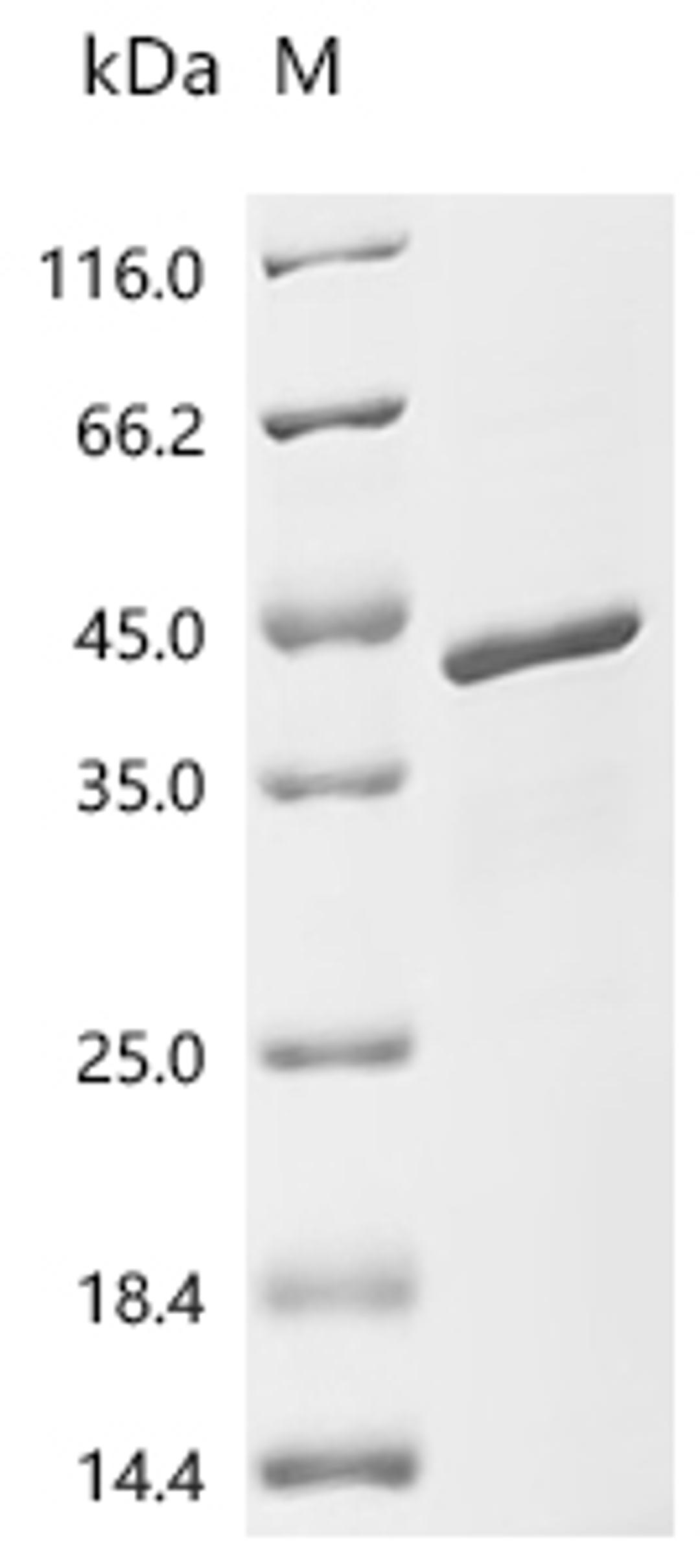 (Tris-Glycine gel) Discontinuous SDS-PAGE (reduced) with 5% enrichment gel and 15% separation gel.