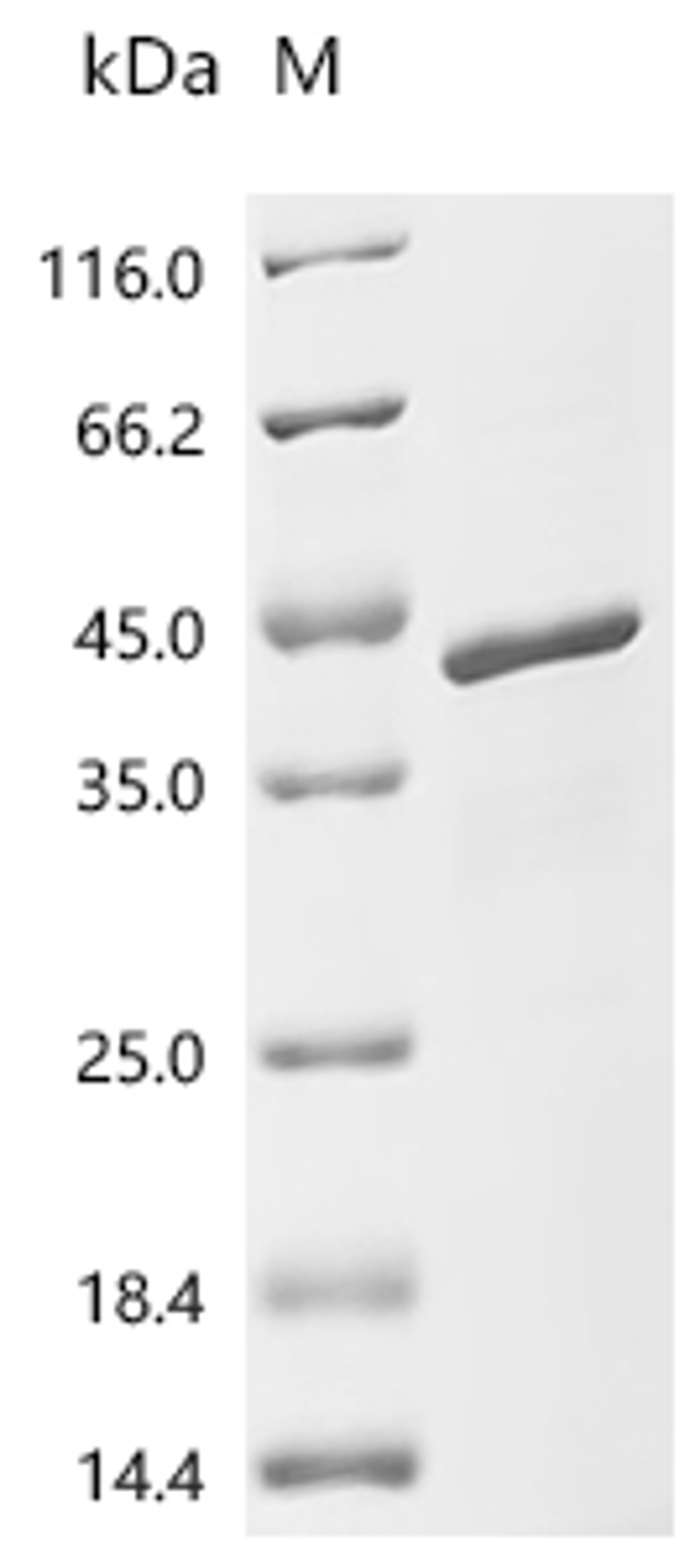 (Tris-Glycine gel) Discontinuous SDS-PAGE (reduced) with 5% enrichment gel and 15% separation gel.
