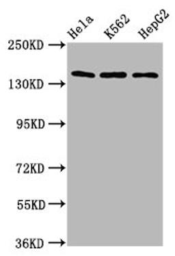 Western Blot. Positive WB detected in: Hela whole cell lysate, K562 whole cell lysate, HepG2 whole cell lysate. All lanes: SF3B1 antibody at 9.8µg/ml. Secondary. Goat polyclonal to rabbit IgG at 1/50000 dilution. Predicted band size: 146, 17 kDa. Observed band size: 146 kDa