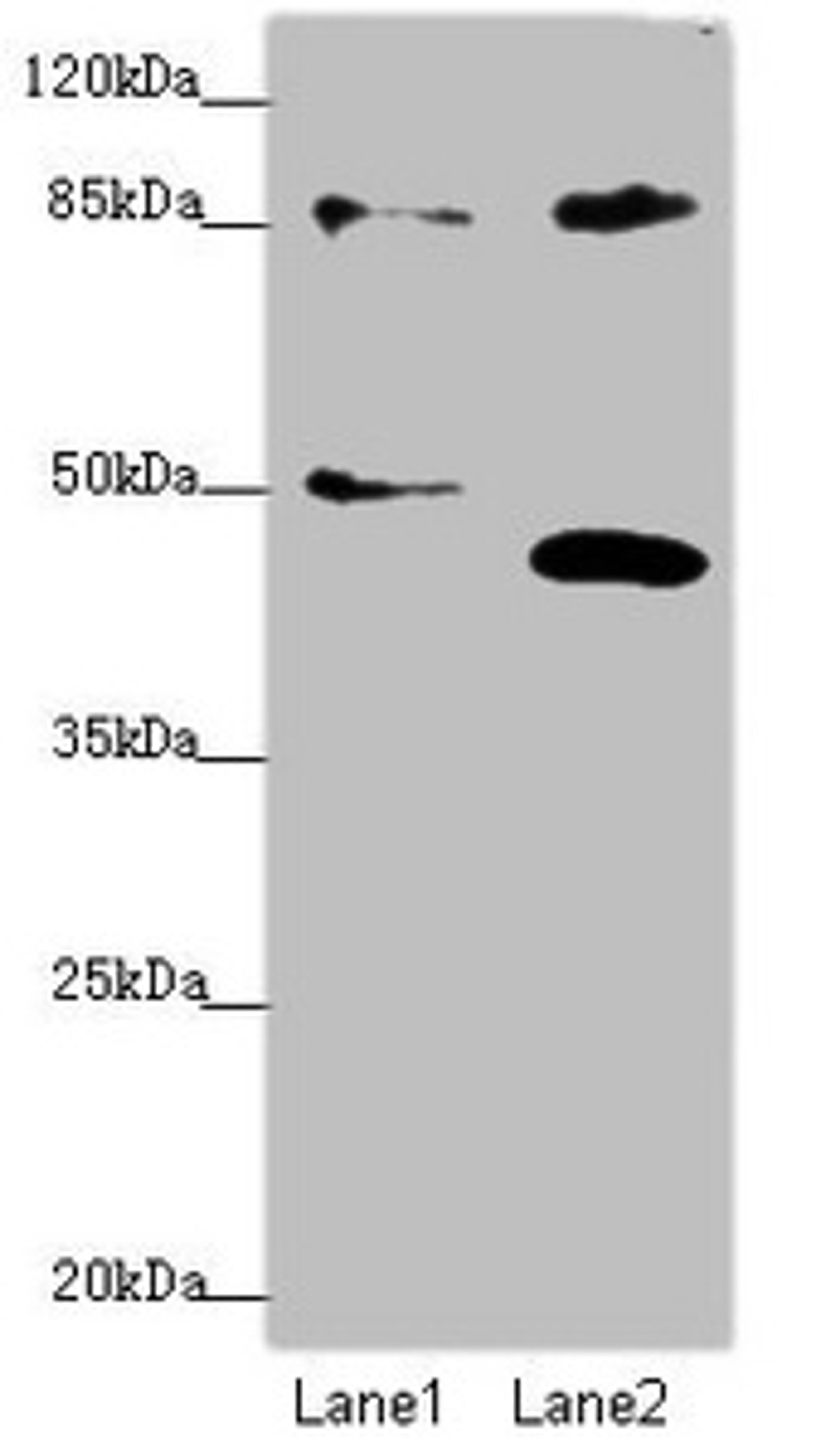 Western blot. All lanes: TAF5 antibody at 1.74 ug/ml. Lane 1: Jurkat whole cell lysate. Lane 2: MCF-7 whole cell lysate. Secondary. Goat polyclonal to rabbit IgG at 1/10000 dilution. Predicted band size: 87, 81 kDa. Observed band size: 87, 40, 51 kDa. 