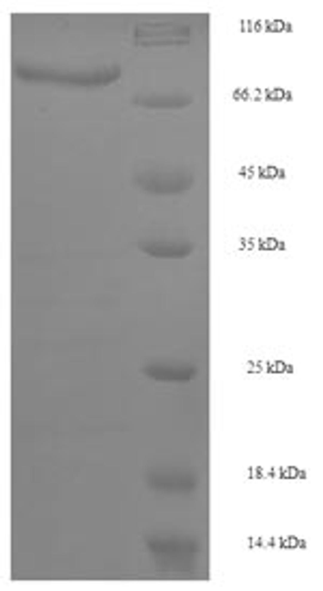 (Tris-Glycine gel) Discontinuous SDS-PAGE (reduced) with 5% enrichment gel and 15% separation gel.