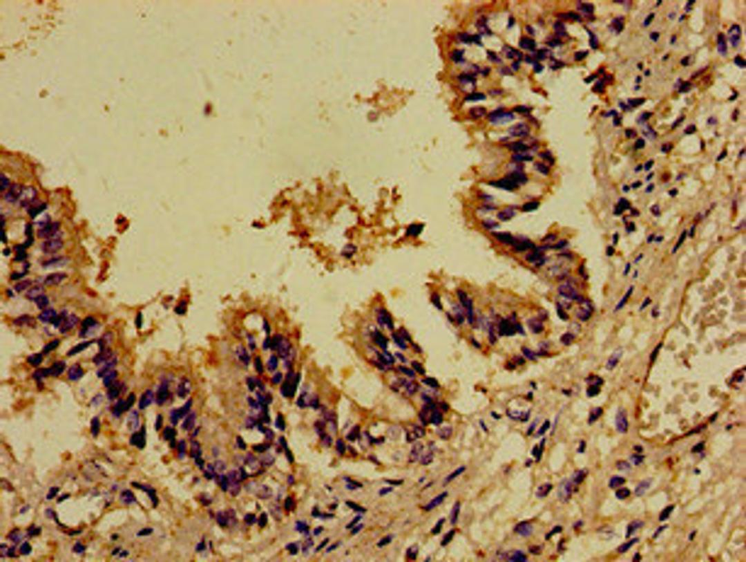 Immunohistochemistry of paraffin-embedded human lung tissue using CSB-PA619864LA01HU at dilution of 1:100