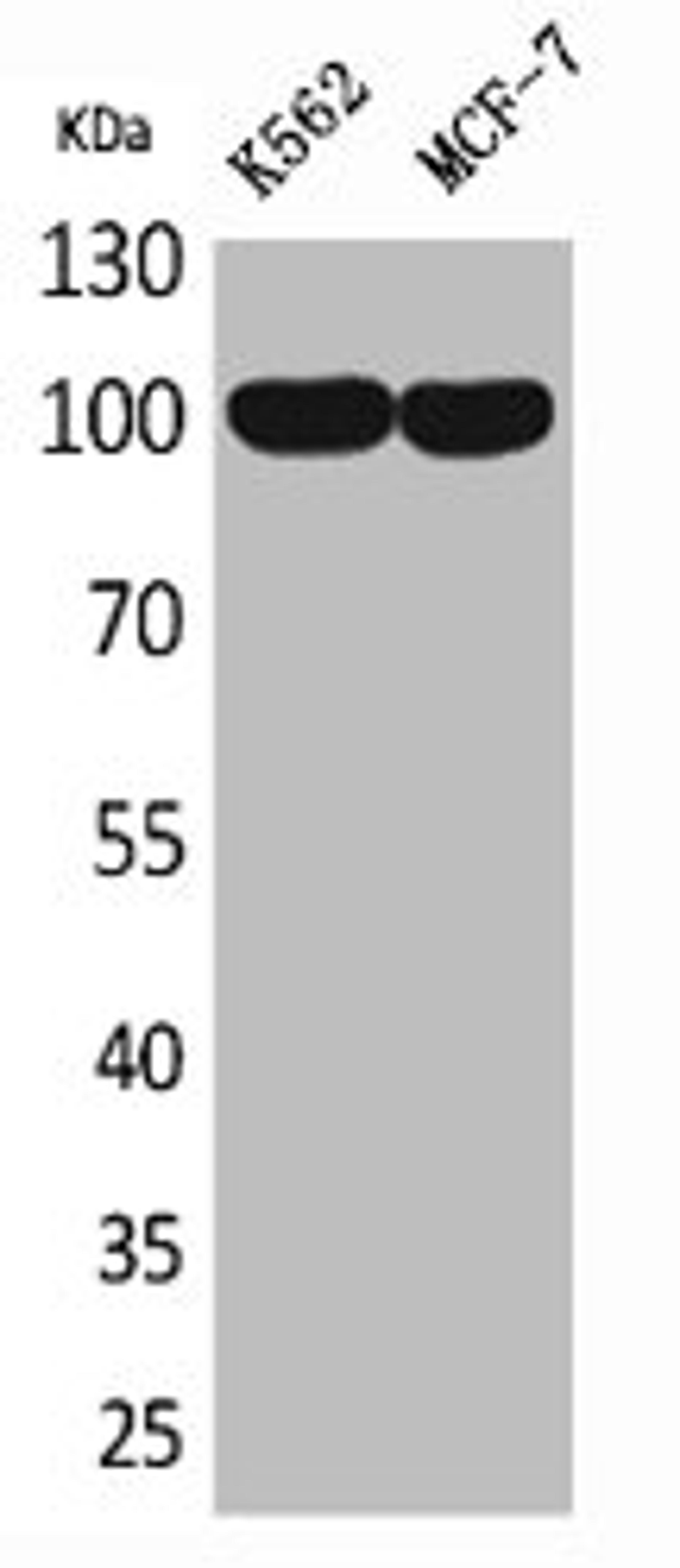 Western Blot analysis of K562 MCF7 cells using CD203c Polyclonal Antibody
