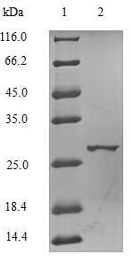 (Tris-Glycine gel) Discontinuous SDS-PAGE (reduced) with 5% enrichment gel and 15% separation gel.