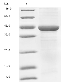 (Tris-Glycine gel) Discontinuous SDS-PAGE (reduced) with 5% enrichment gel and 15% separation gel.