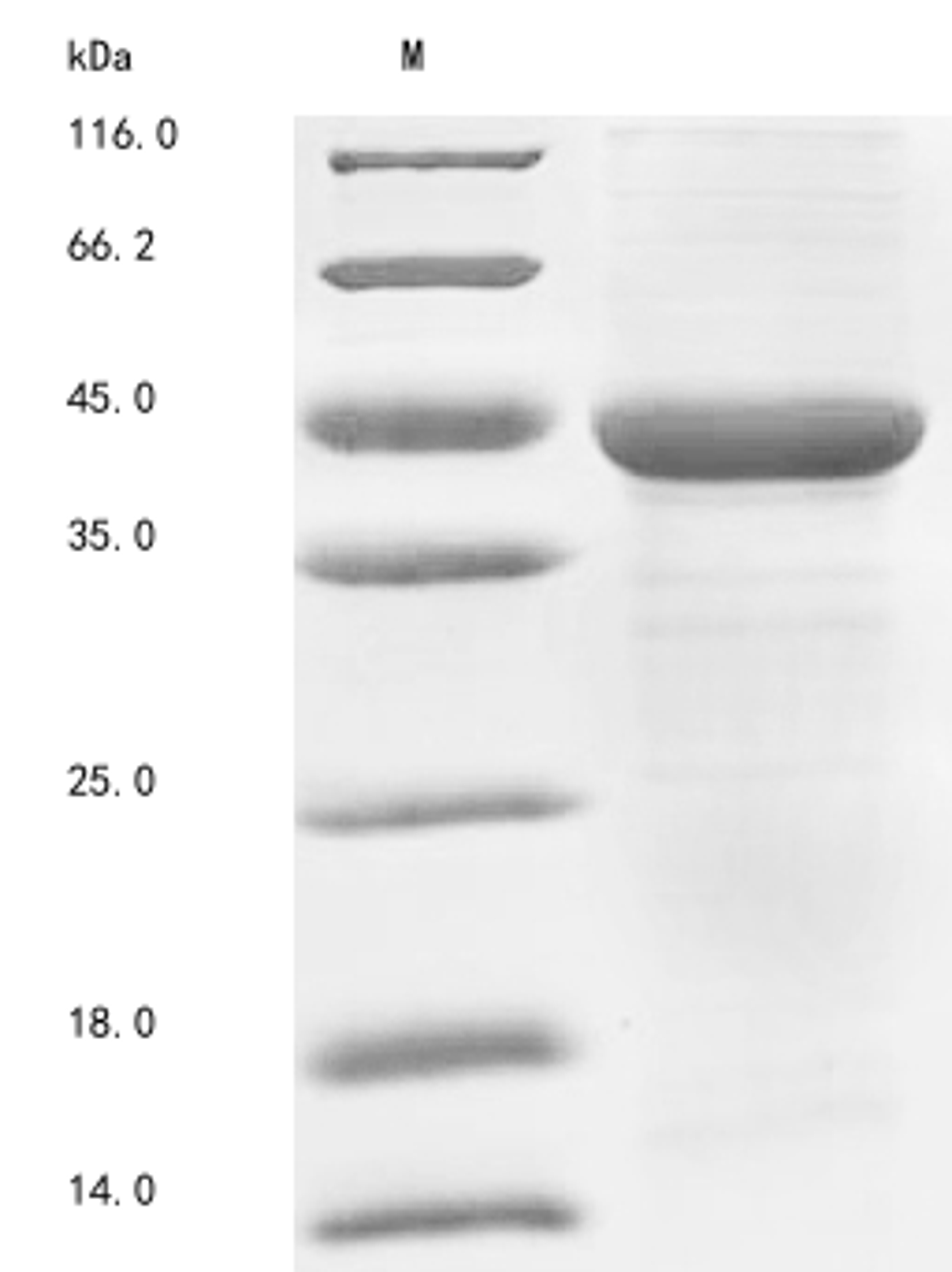 (Tris-Glycine gel) Discontinuous SDS-PAGE (reduced) with 5% enrichment gel and 15% separation gel.
