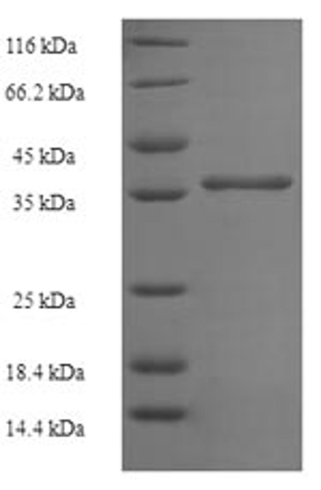 (Tris-Glycine gel) Discontinuous SDS-PAGE (reduced) with 5% enrichment gel and 15% separation gel.
