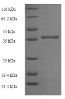 (Tris-Glycine gel) Discontinuous SDS-PAGE (reduced) with 5% enrichment gel and 15% separation gel.