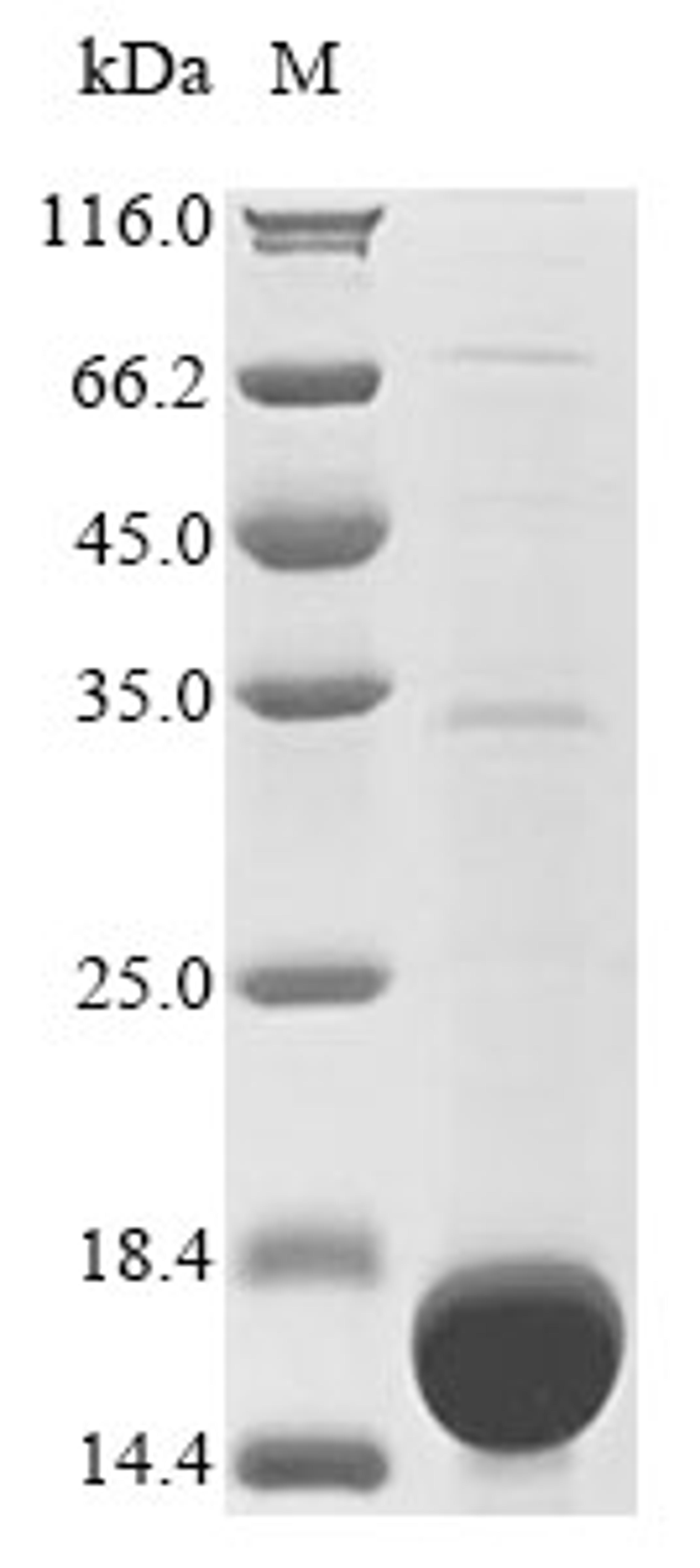 (Tris-Glycine gel) Discontinuous SDS-PAGE (reduced) with 5% enrichment gel and 15% separation gel.